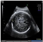 Sustainability 15 06189 i018