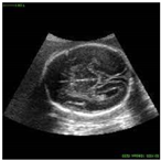 Sustainability 15 06189 i020