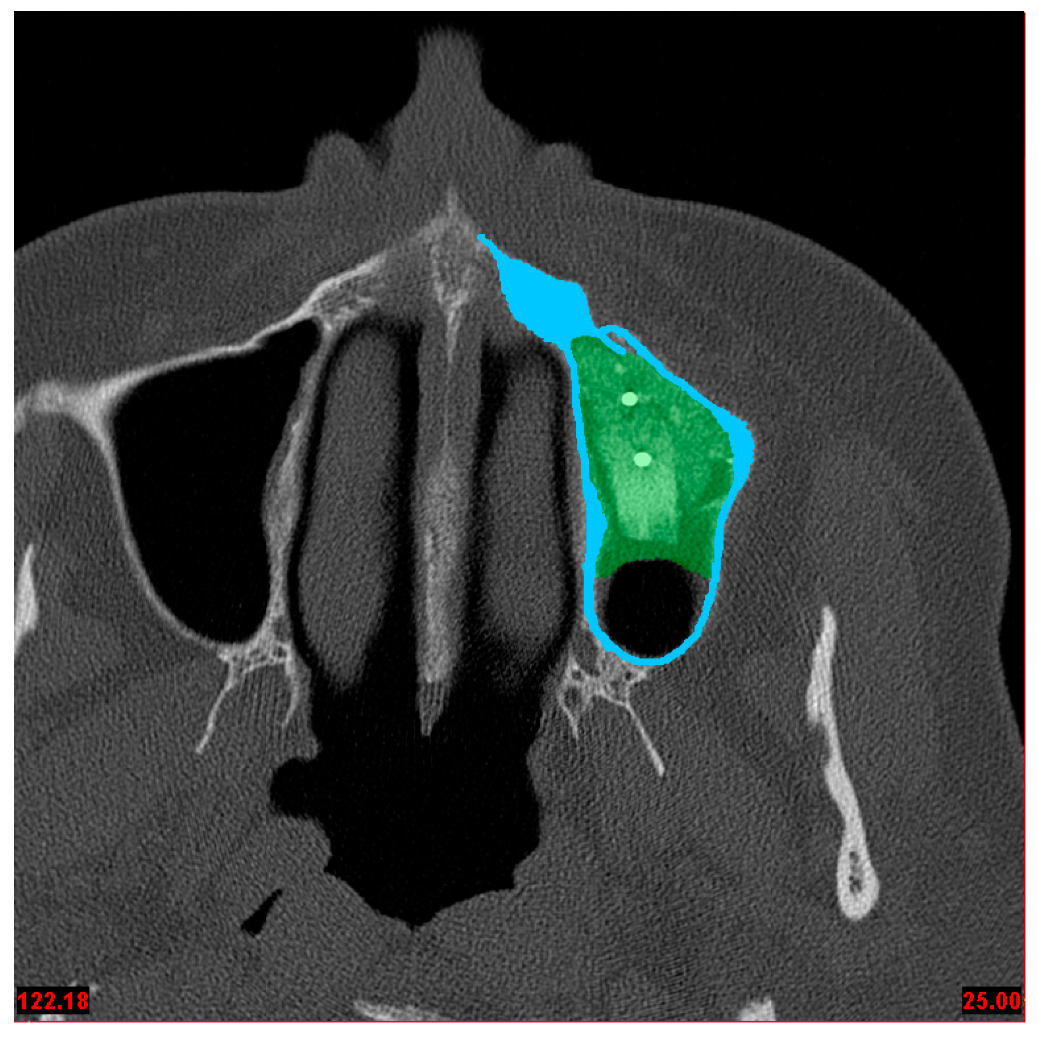 Symmetry 10 00033 g001