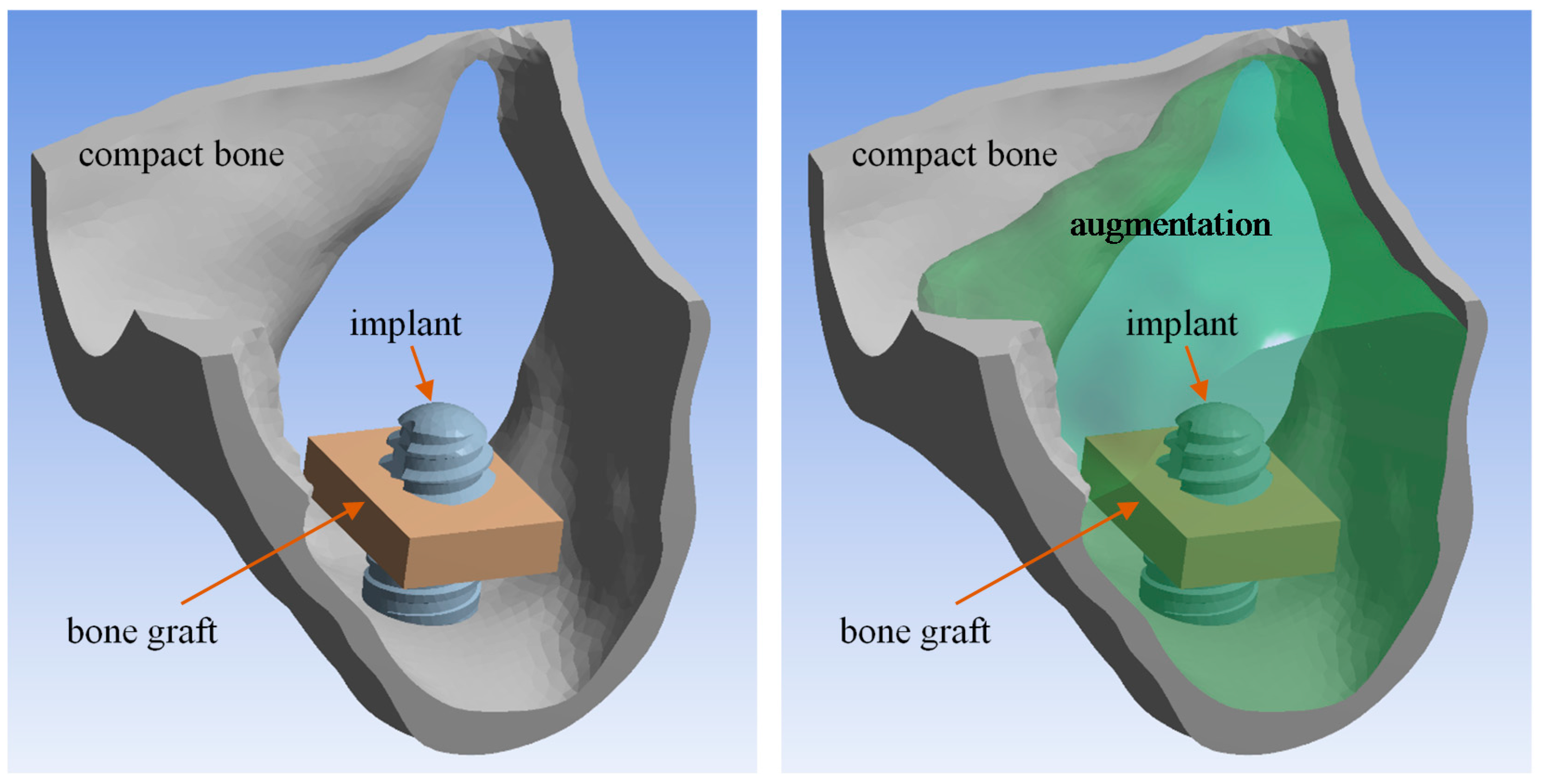 Symmetry 10 00033 g003