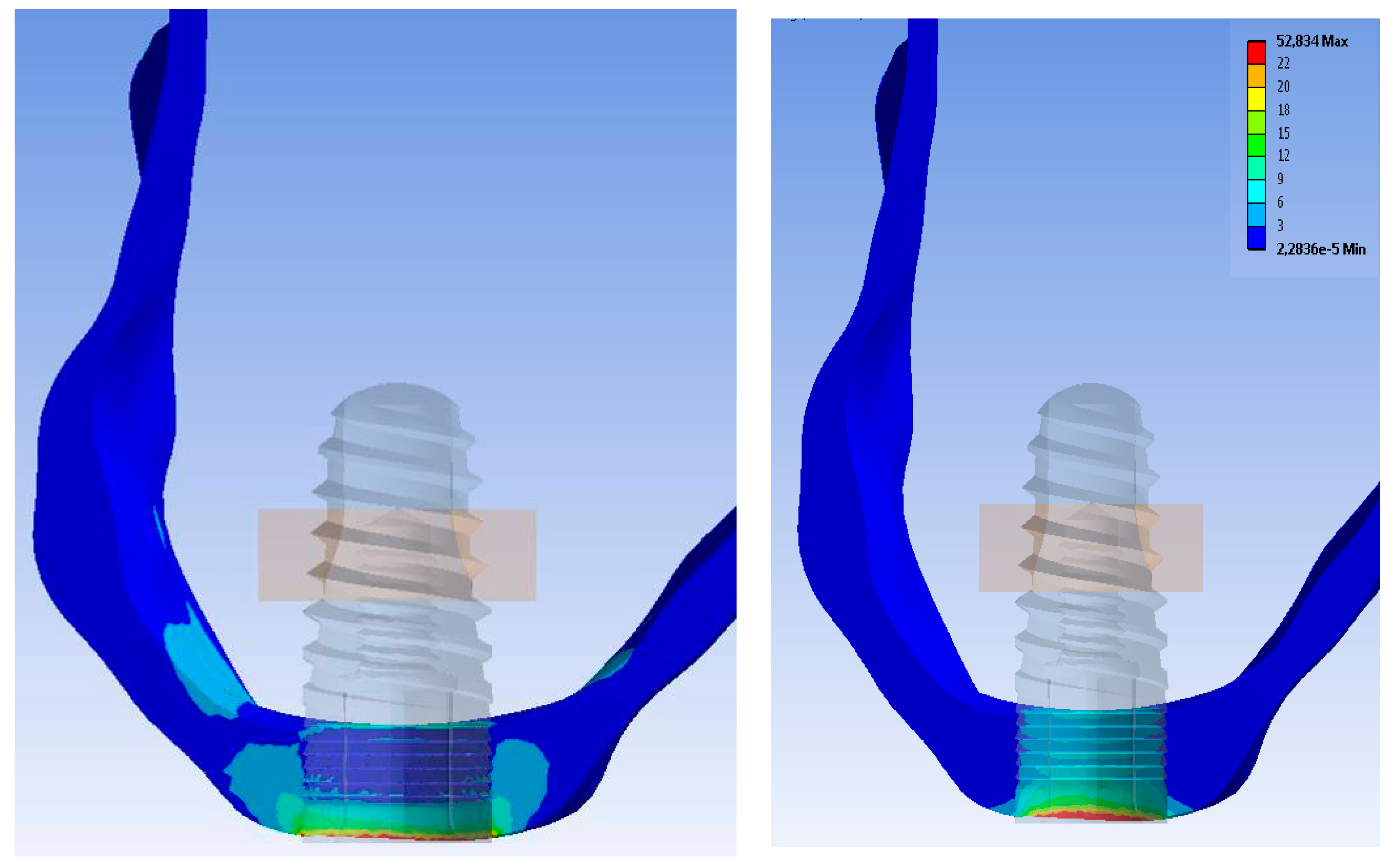Symmetry 10 00033 g005