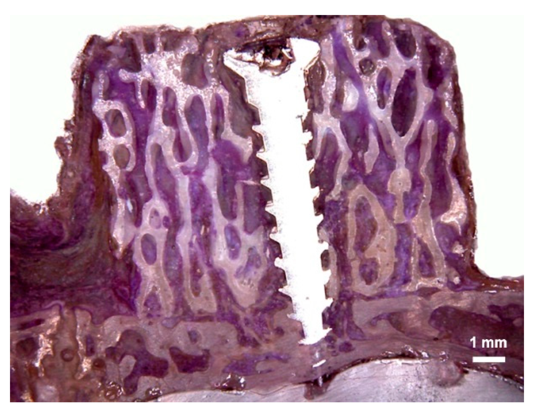 Symmetry 11 00641 g004