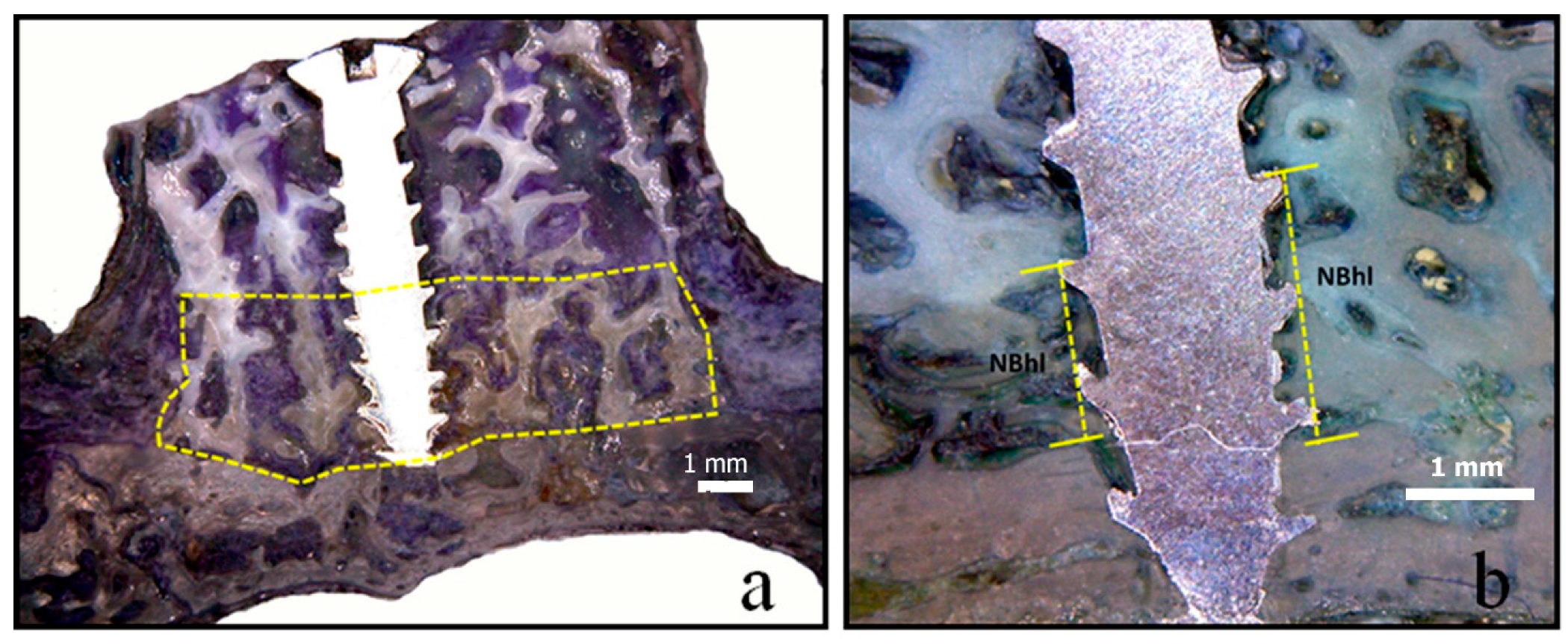 Symmetry 11 00641 g005