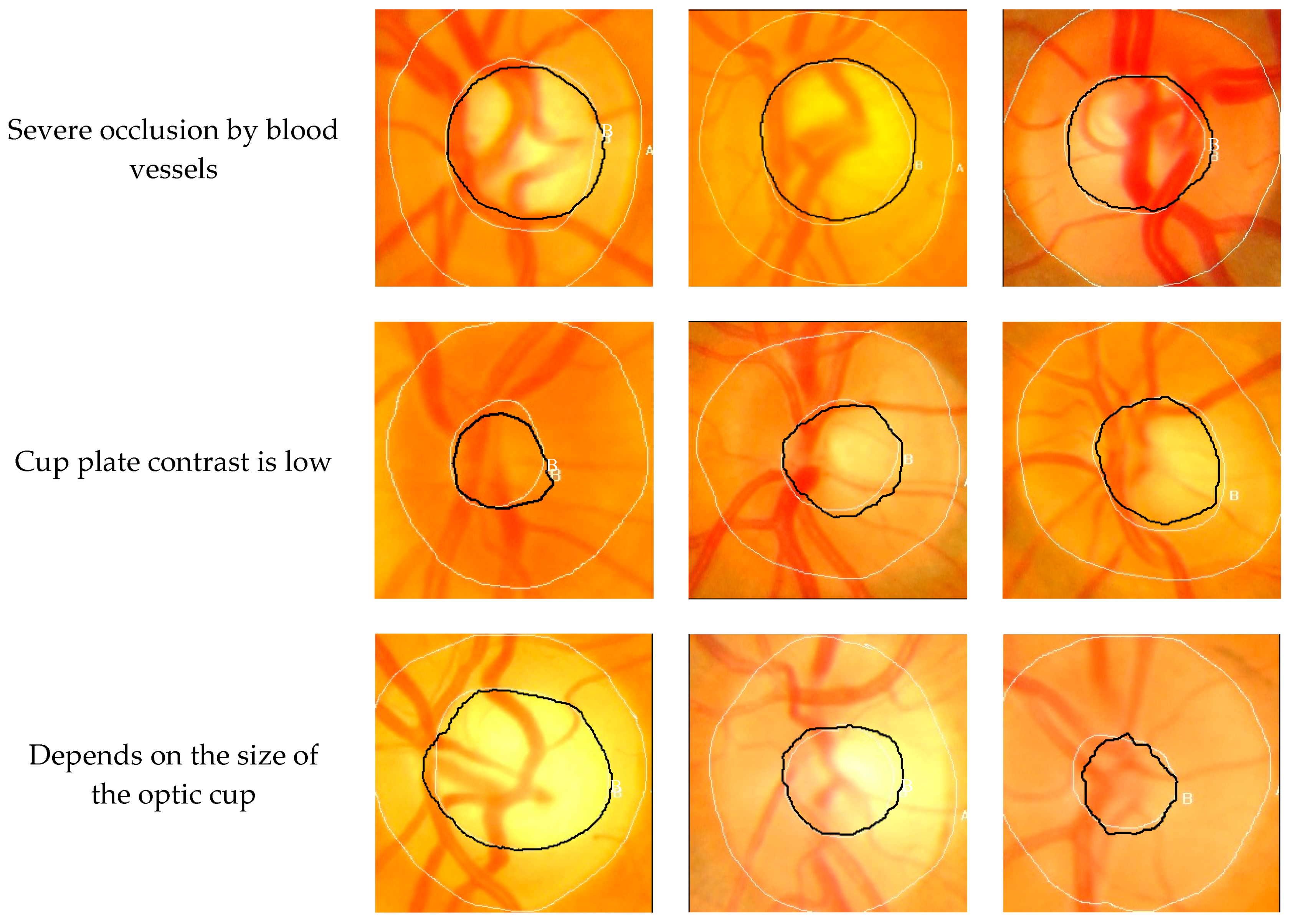 Symmetry 11 00933 g006