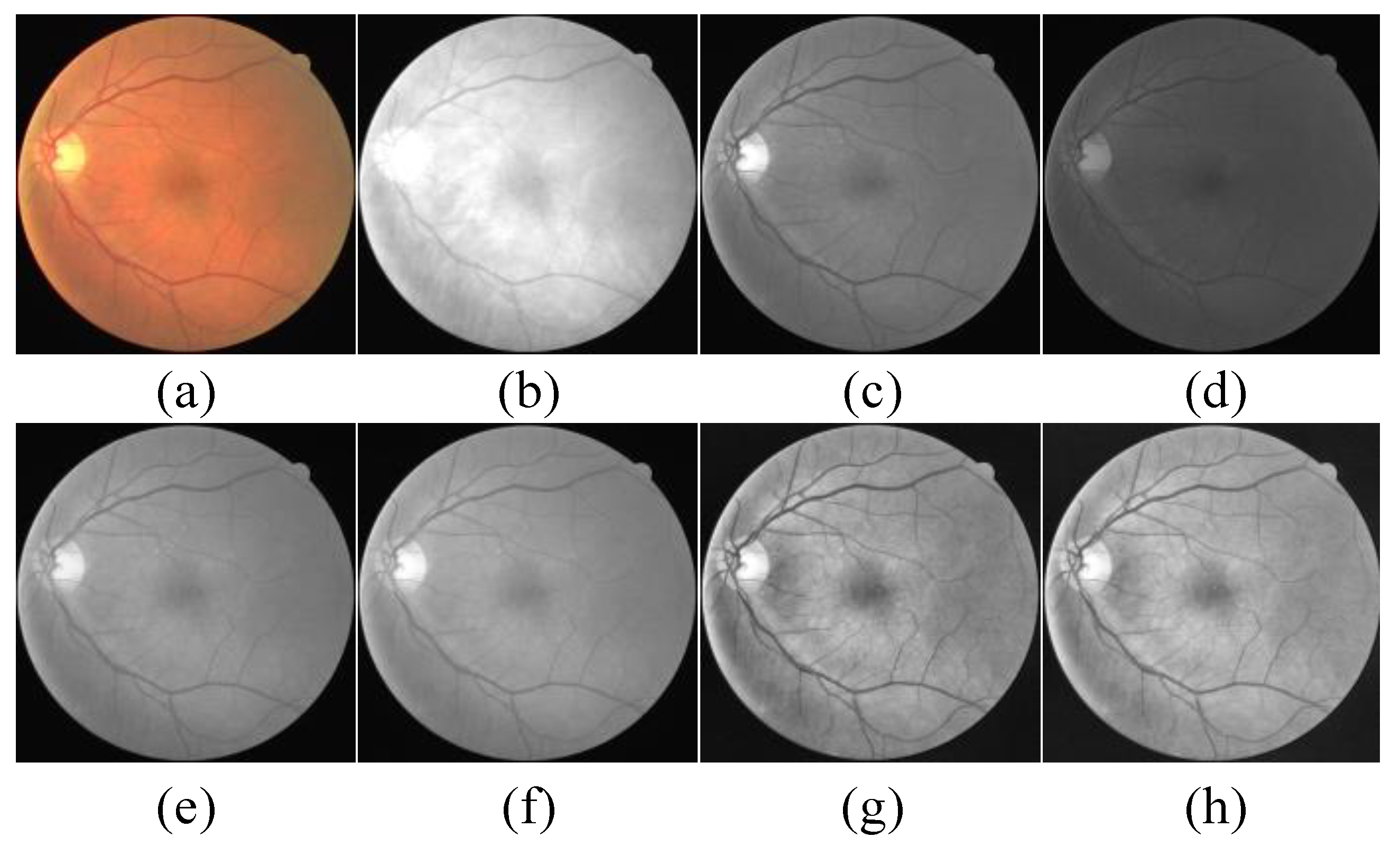 Symmetry 11 01112 g003