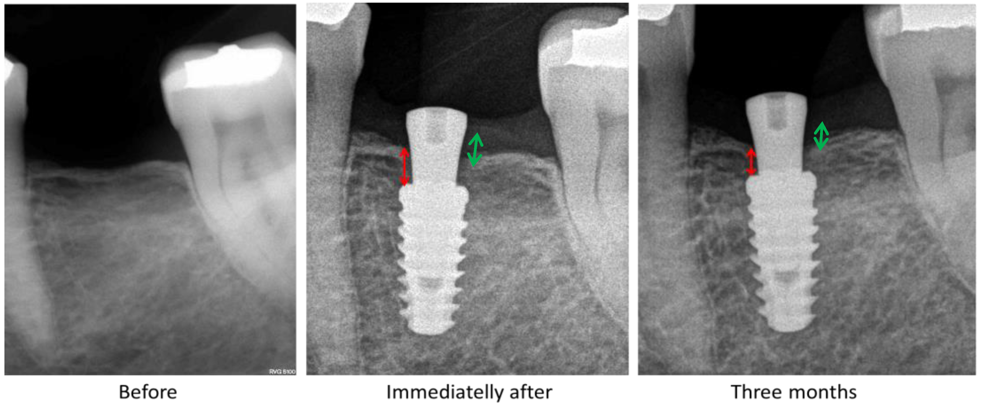 Symmetry 11 01138 g006