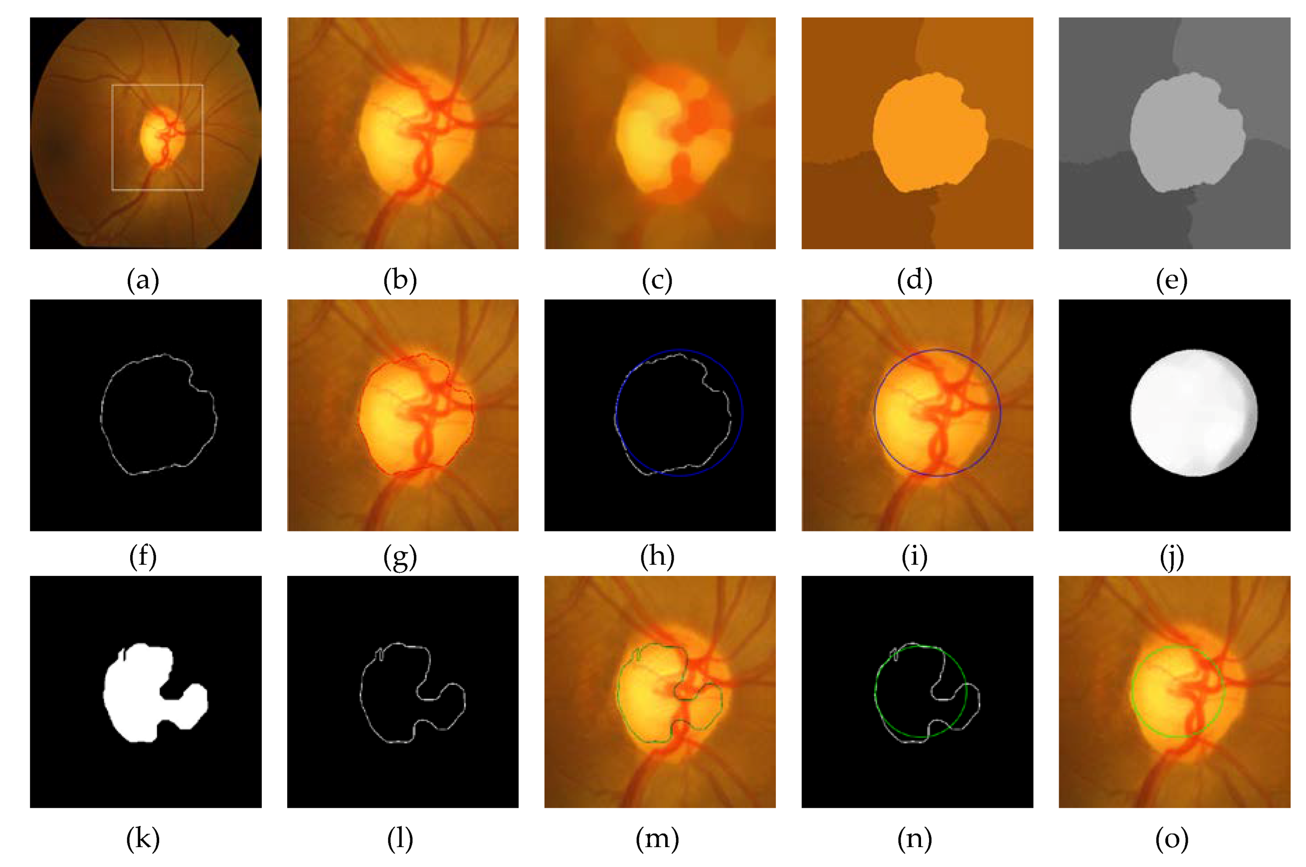 Symmetry 11 01267 g003
