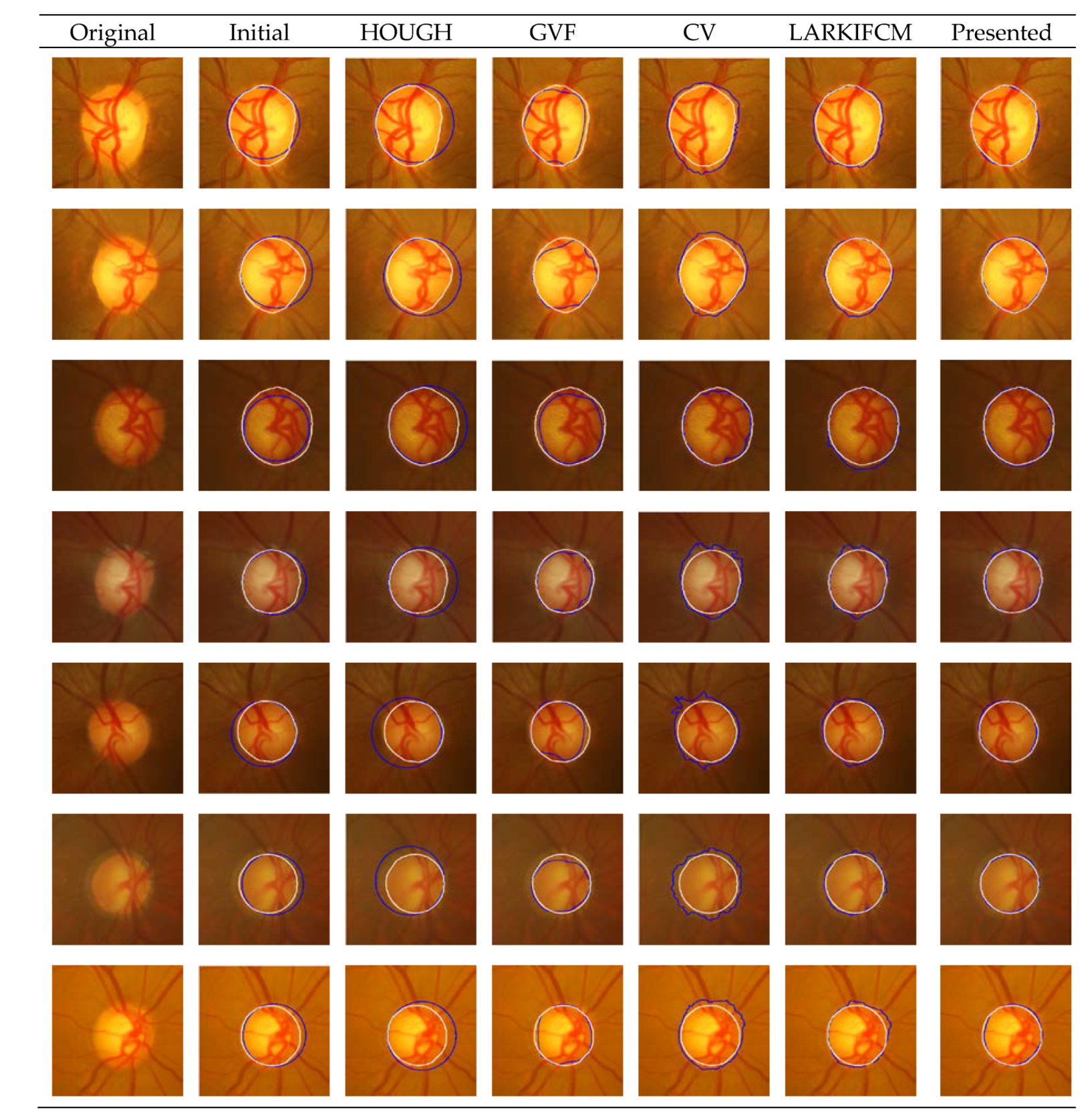 Symmetry 11 01267 g005