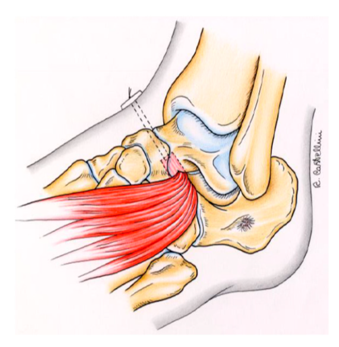 Symmetry 11 01317 g005