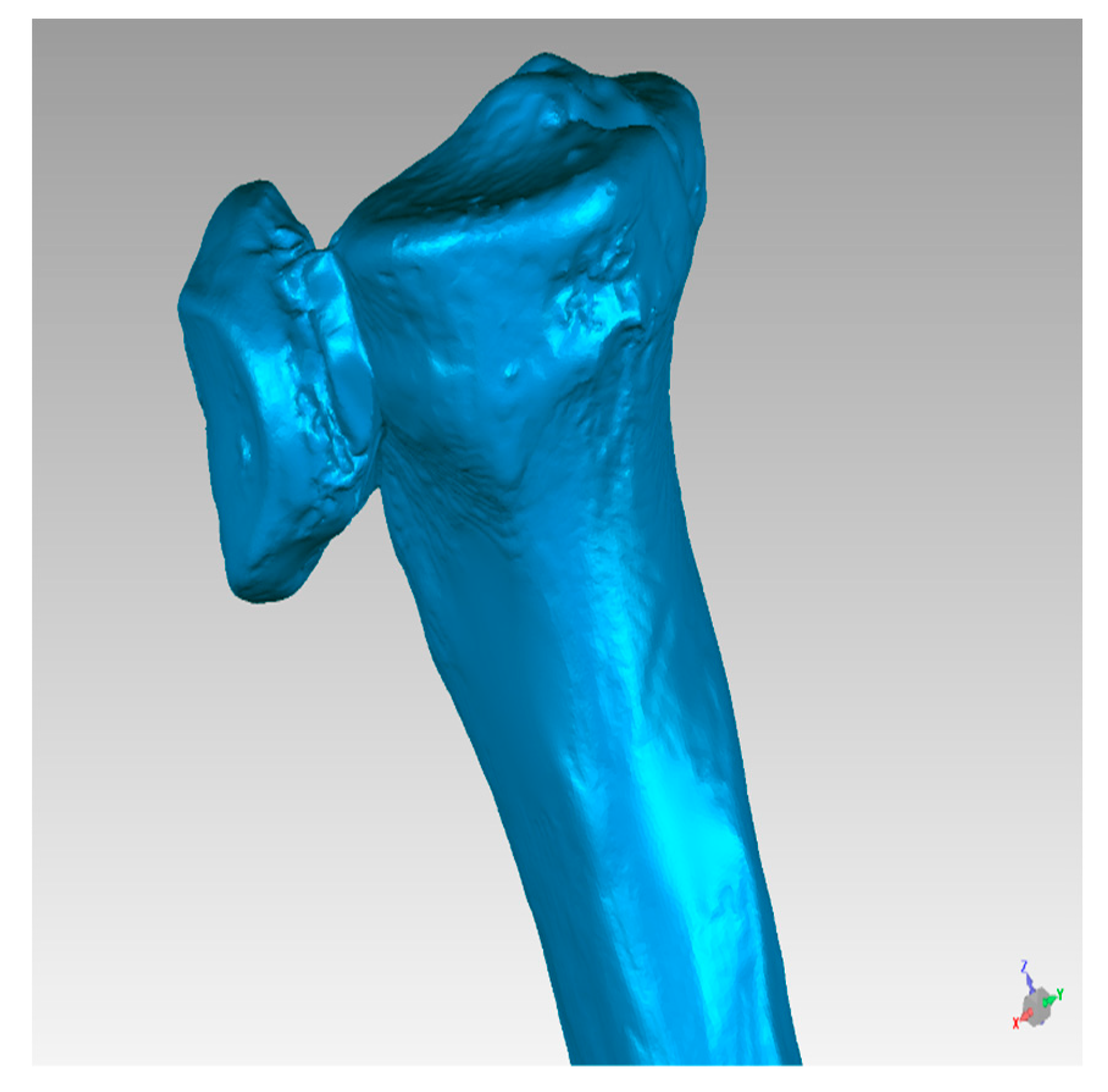 Symmetry 11 01317 g015