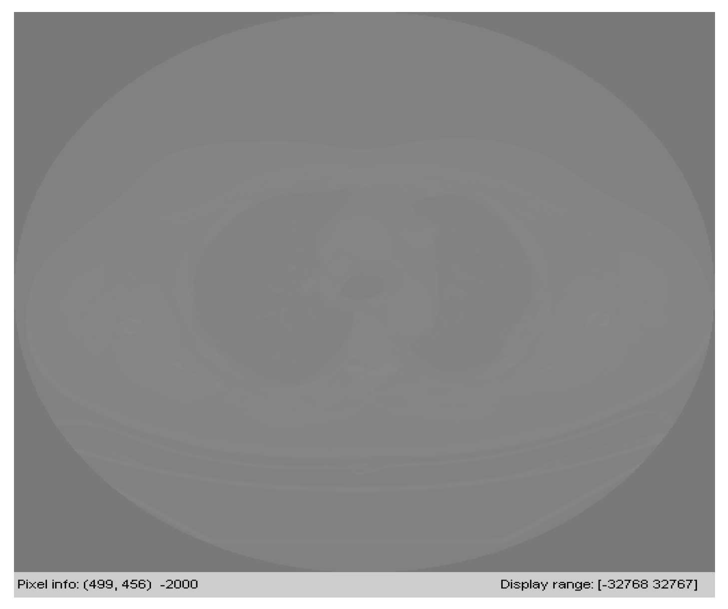 Symmetry 12 00386 g003