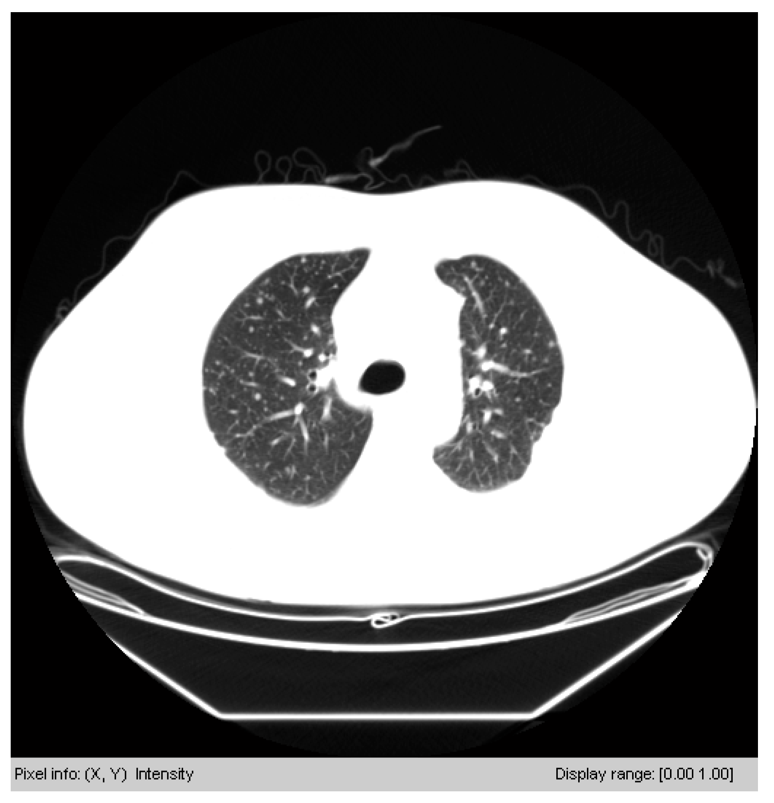 Symmetry 12 00386 g007