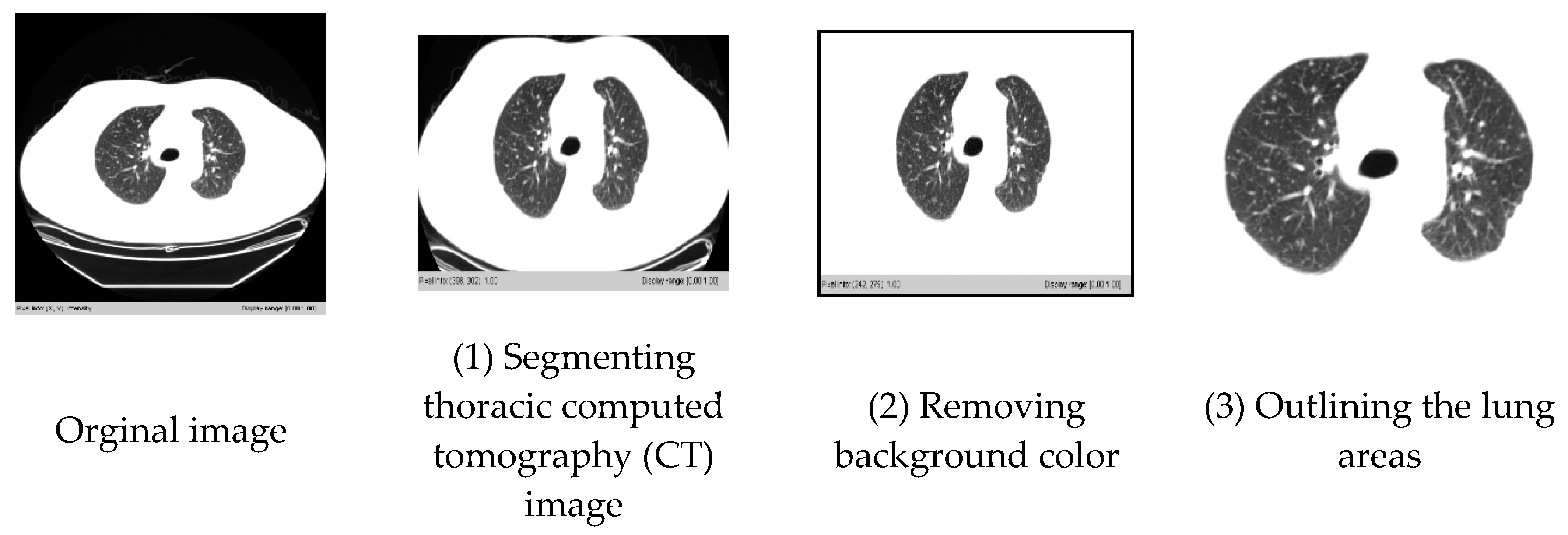 Symmetry 12 00386 g008