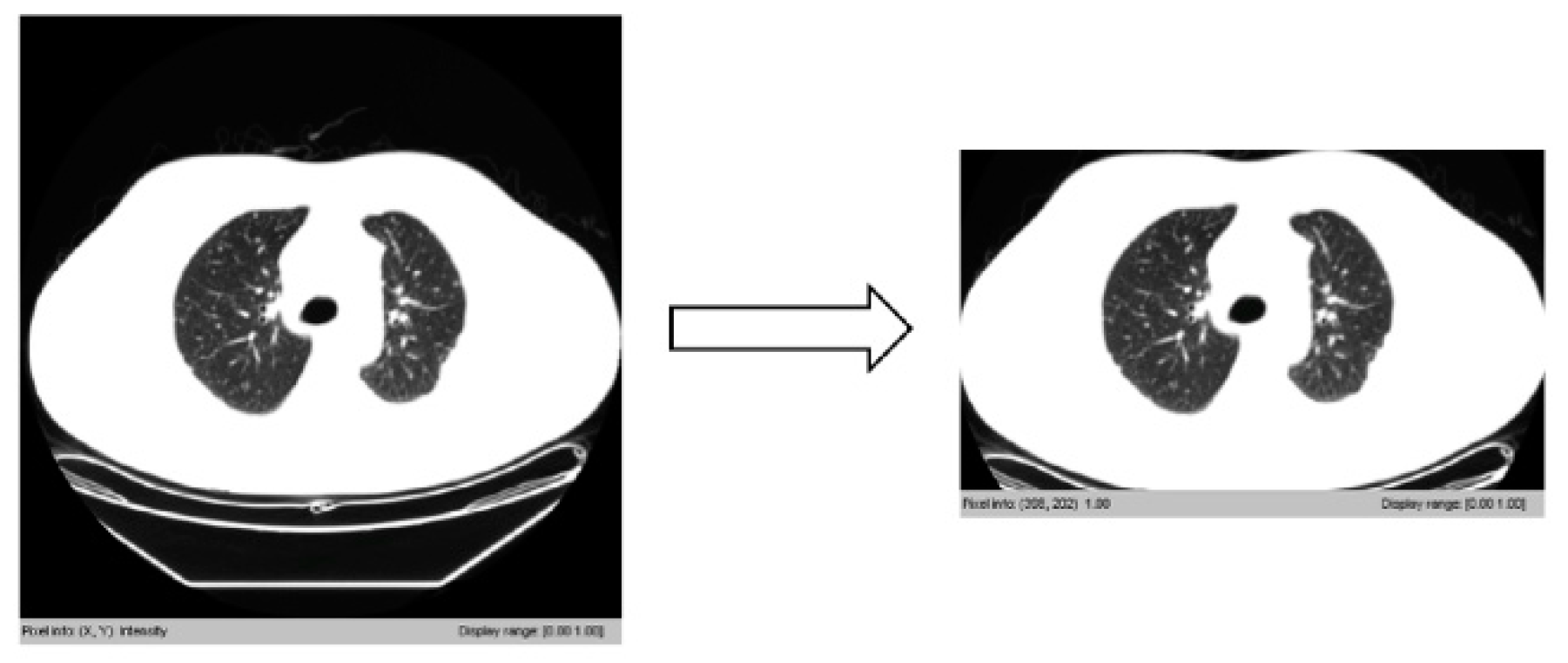 Symmetry 12 00386 g009