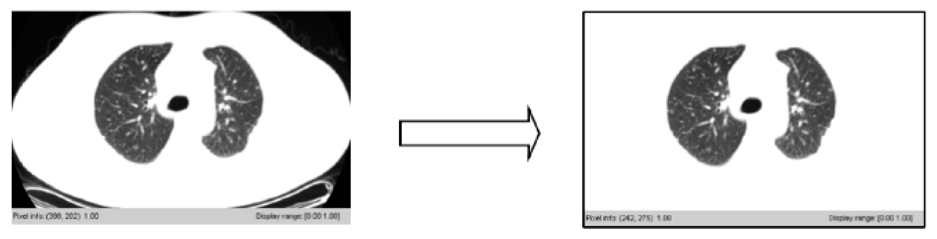 Symmetry 12 00386 g010