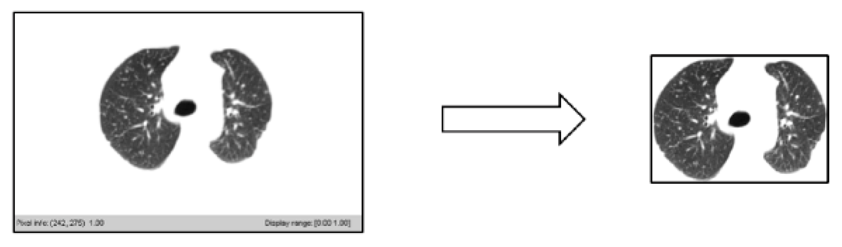 Symmetry 12 00386 g011