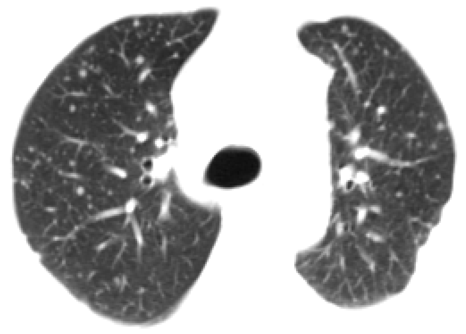 Symmetry 12 00386 g012