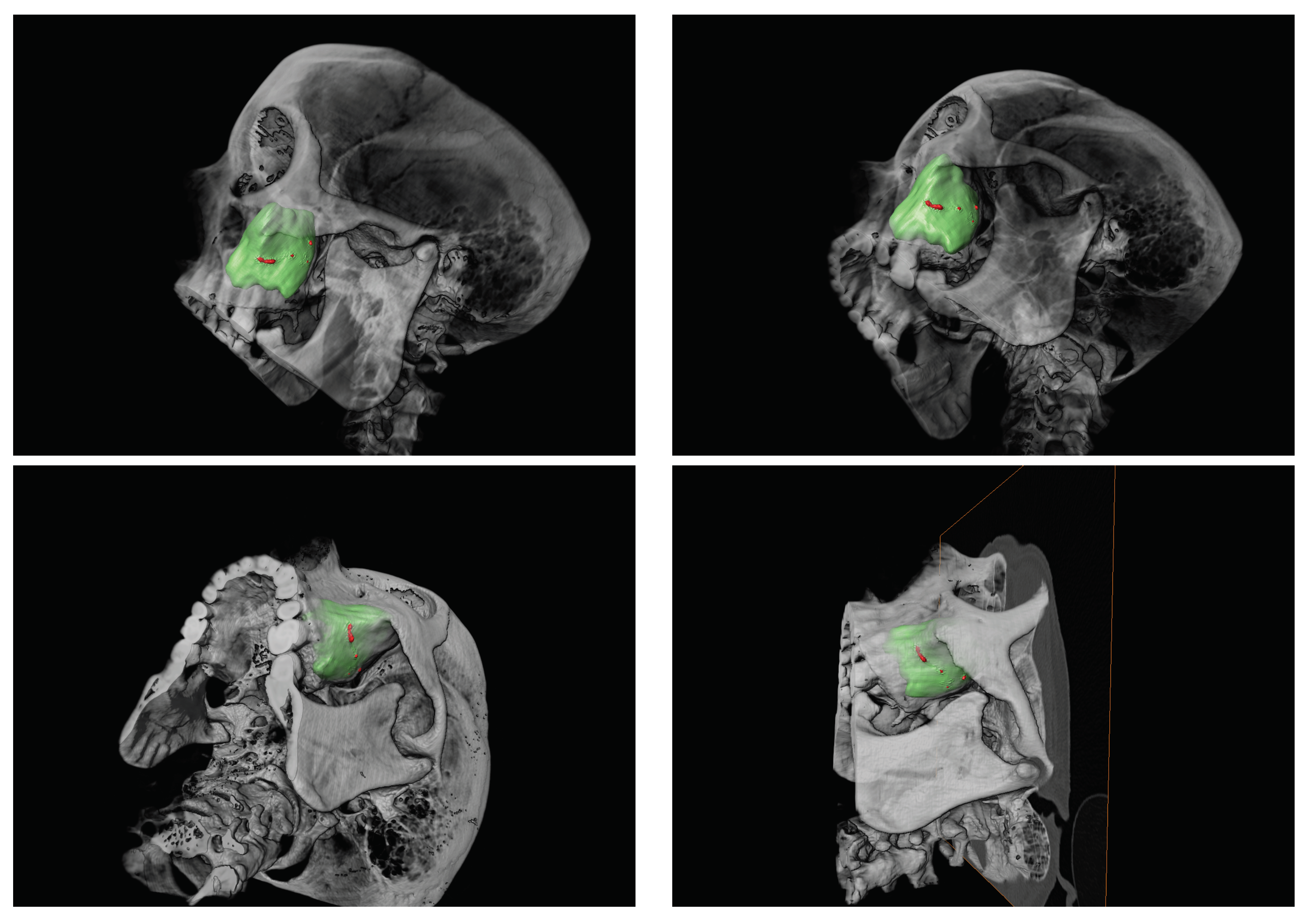 Symmetry 12 01177 g001