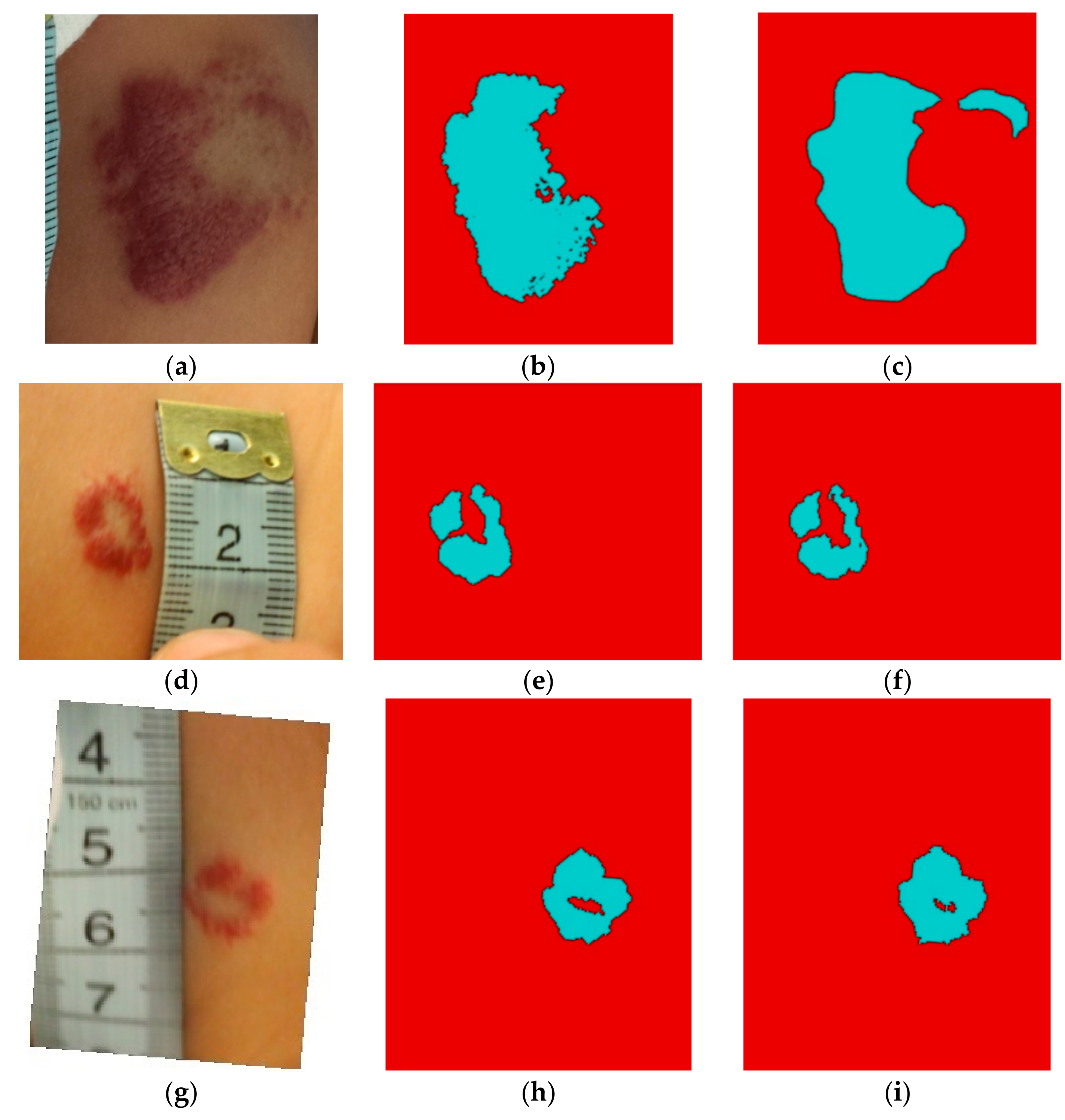 Symmetry 13 00138 g011