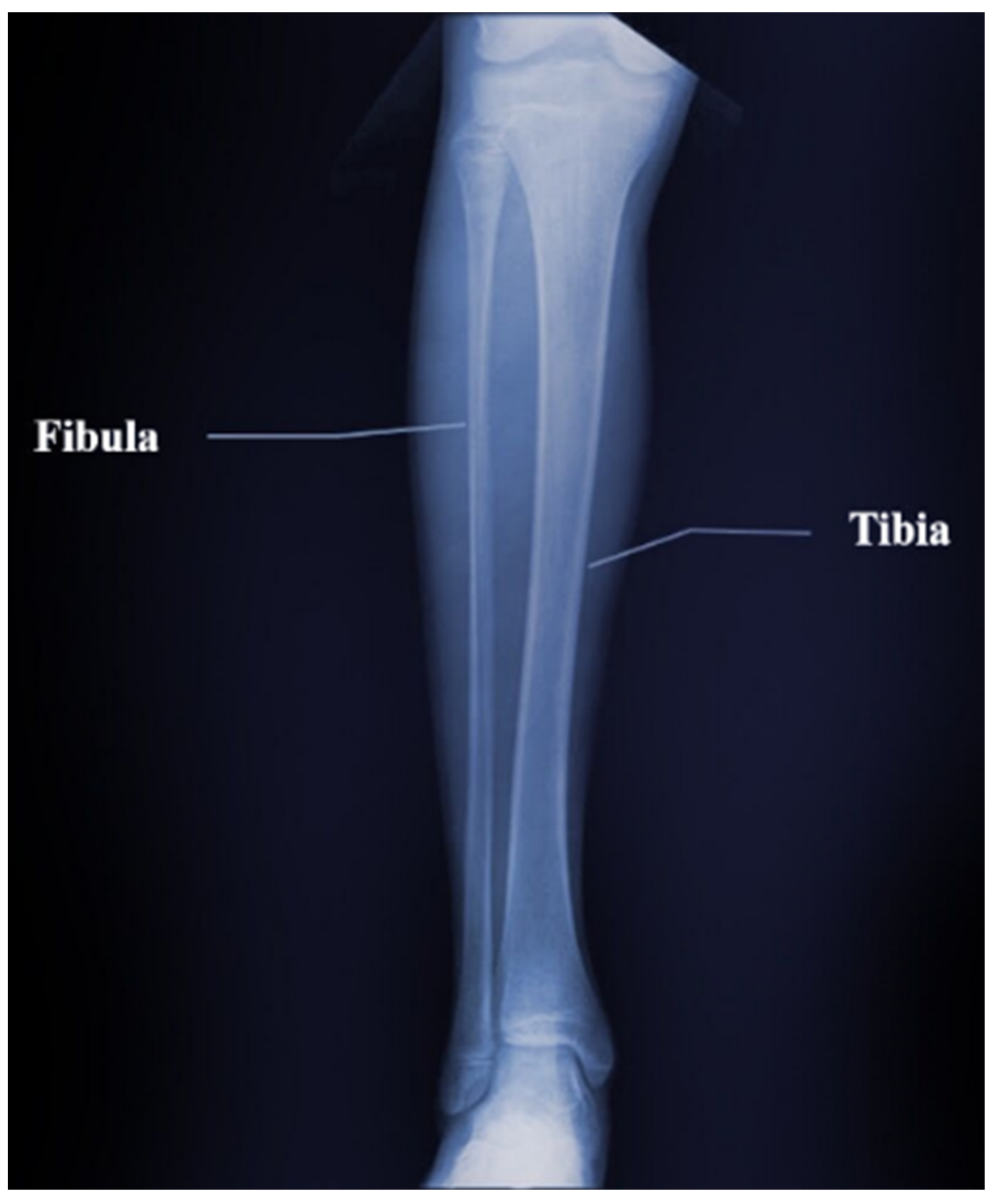 Symmetry 13 00260 g030 Symmetry 13 00260 g030
