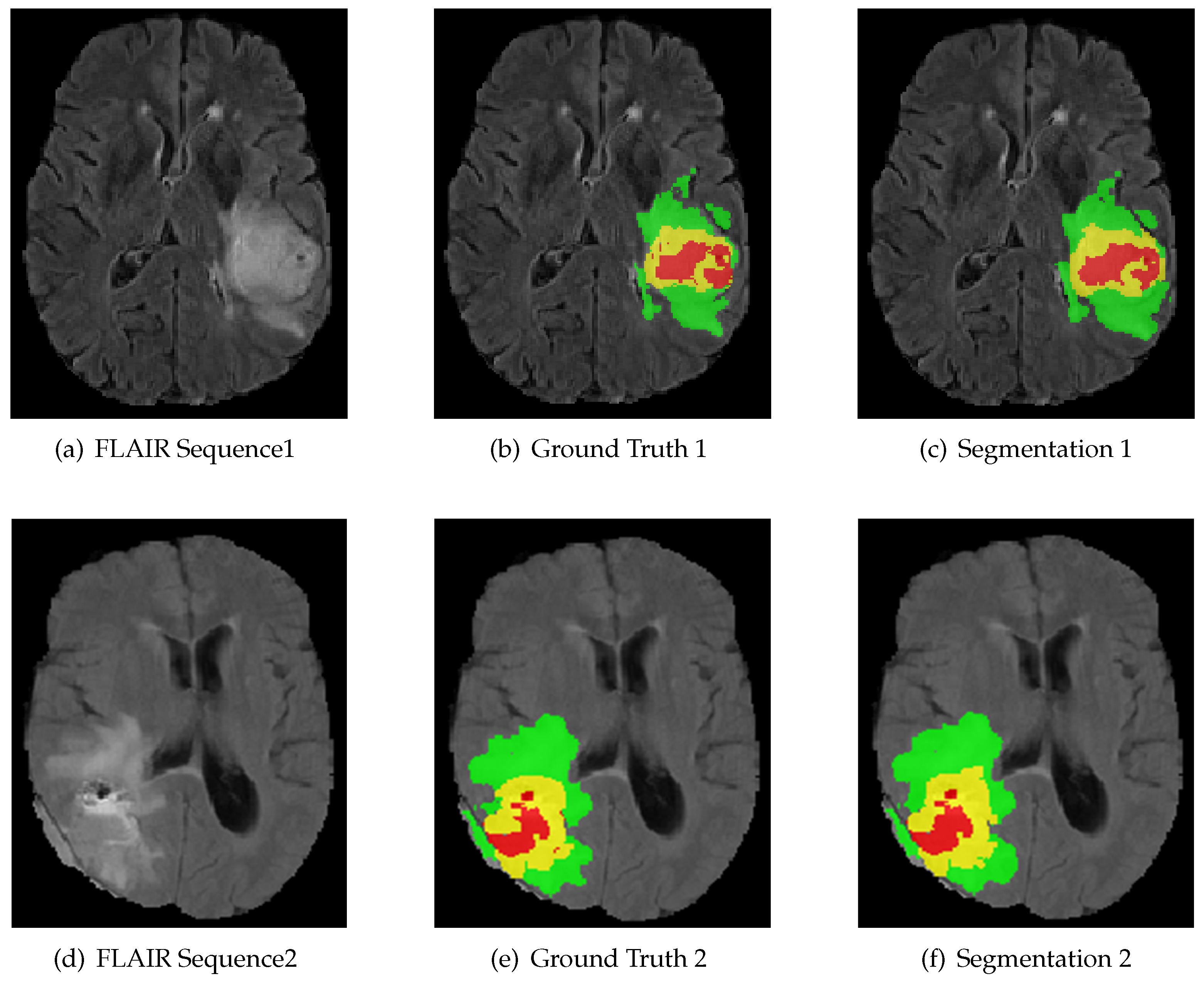 Symmetry 13 00320 g005