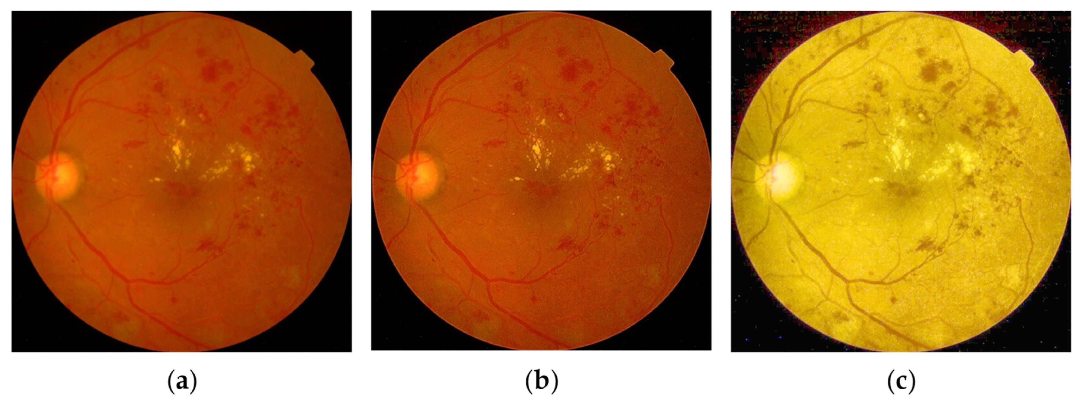 Symmetry 13 00670 g004