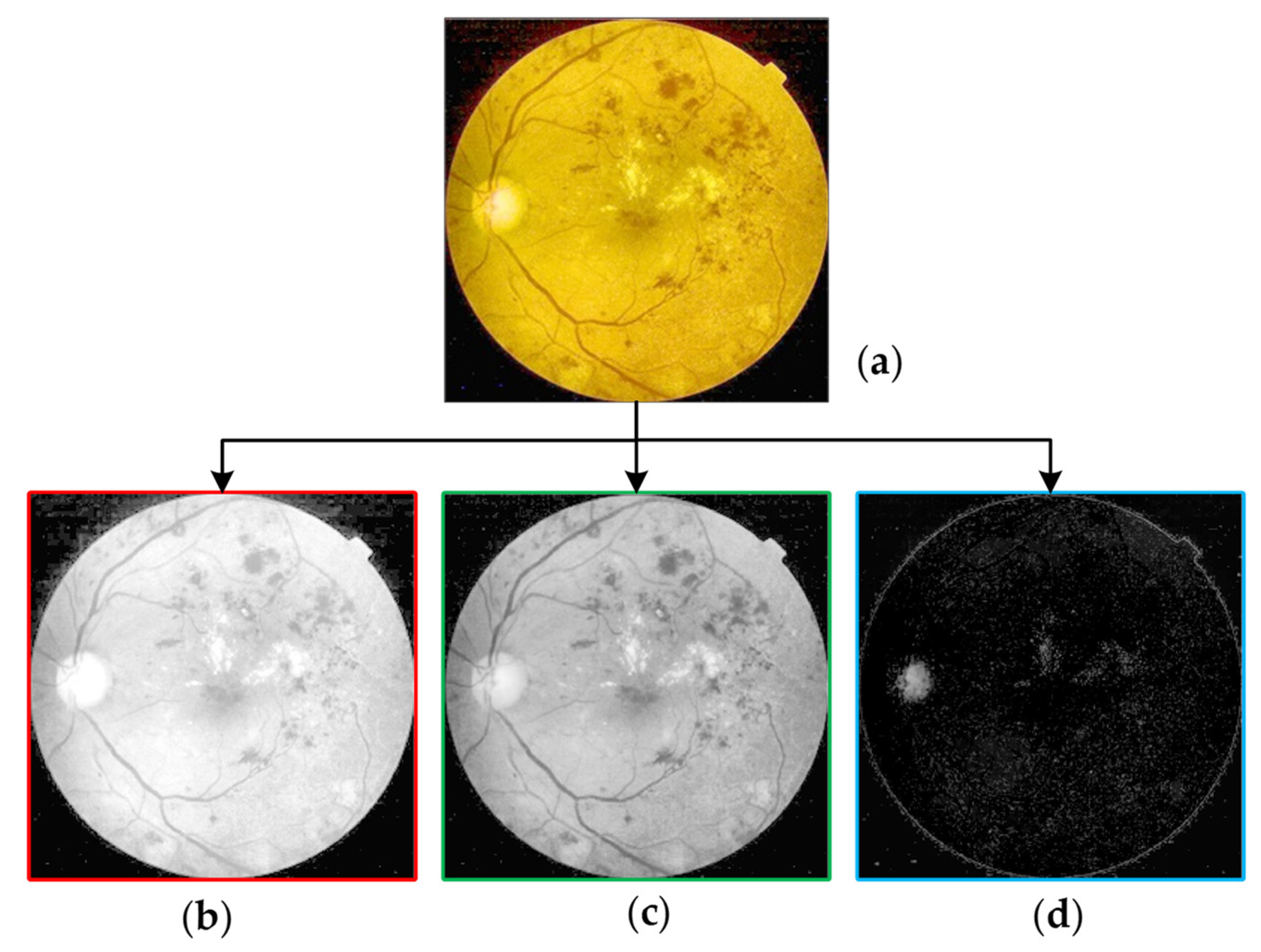 Symmetry 13 00670 g005