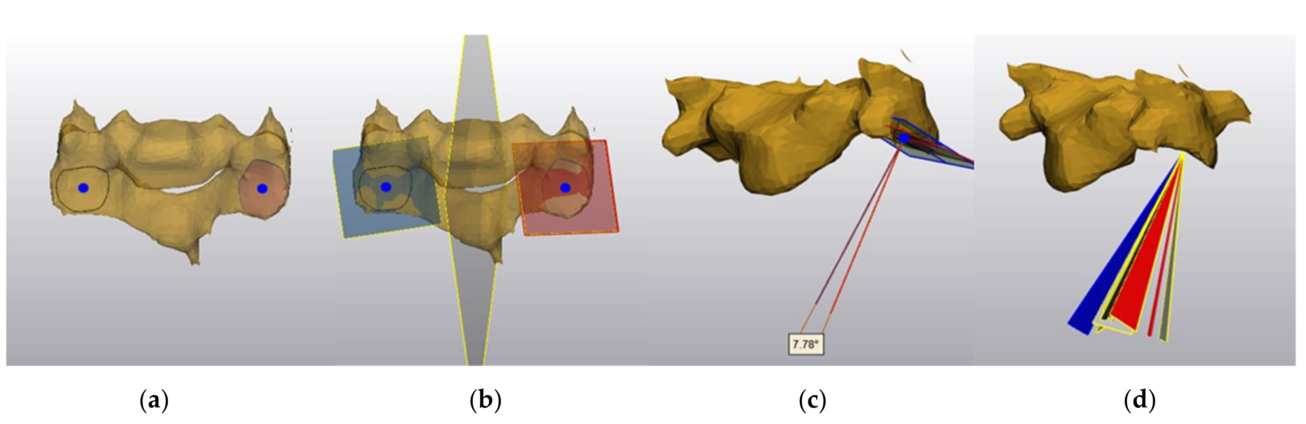 Symmetry 13 00739 g001