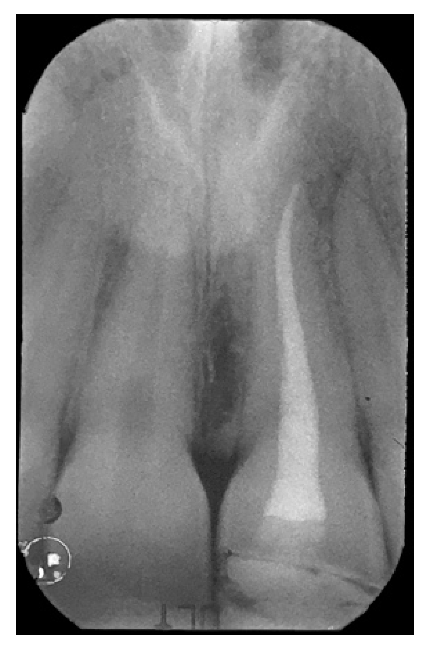 Symmetry 13 00797 g002