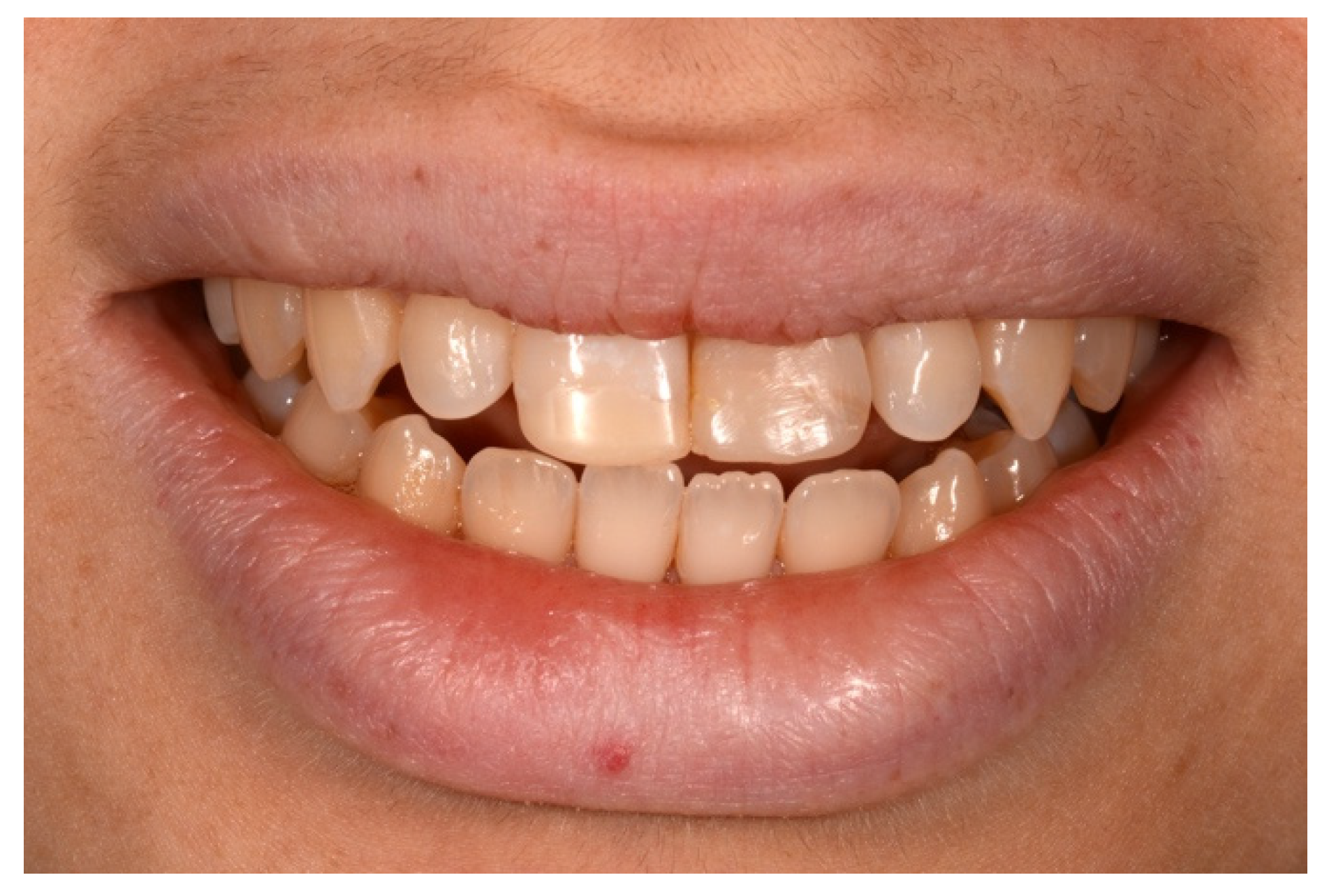 Symmetry 13 00797 g003