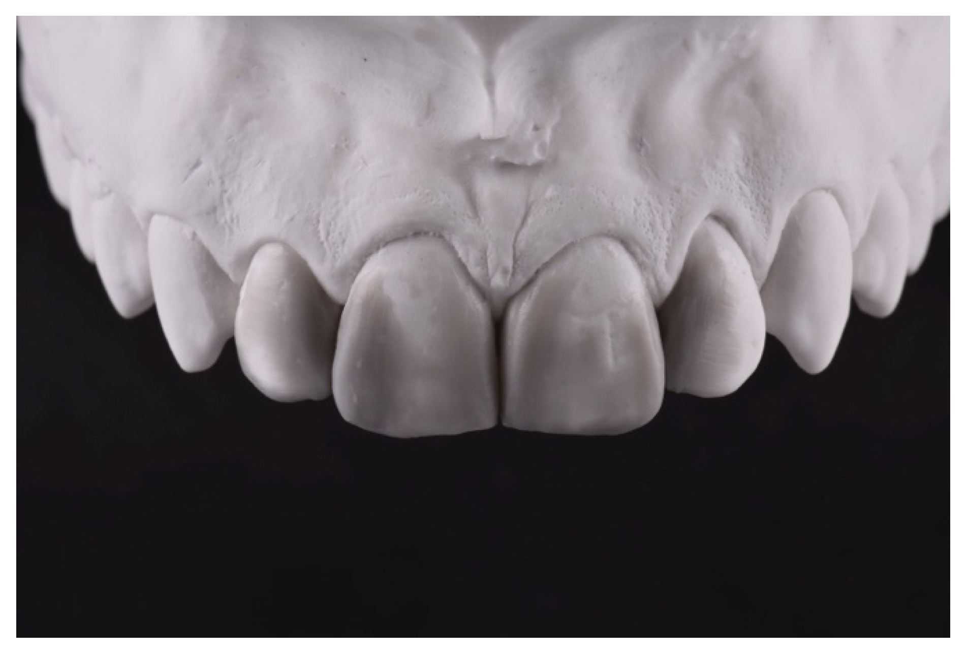 Symmetry 13 00797 g004