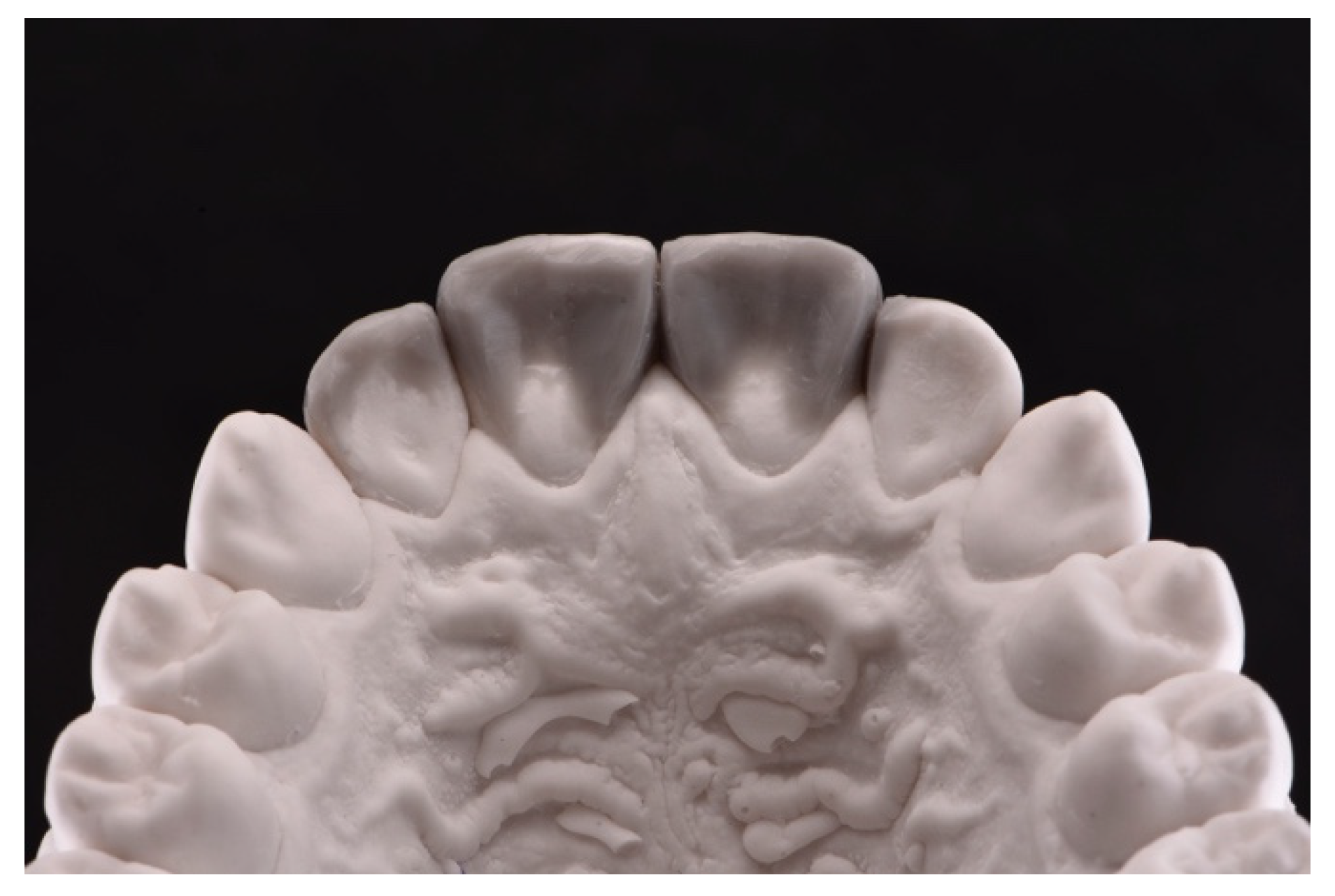 Symmetry 13 00797 g005