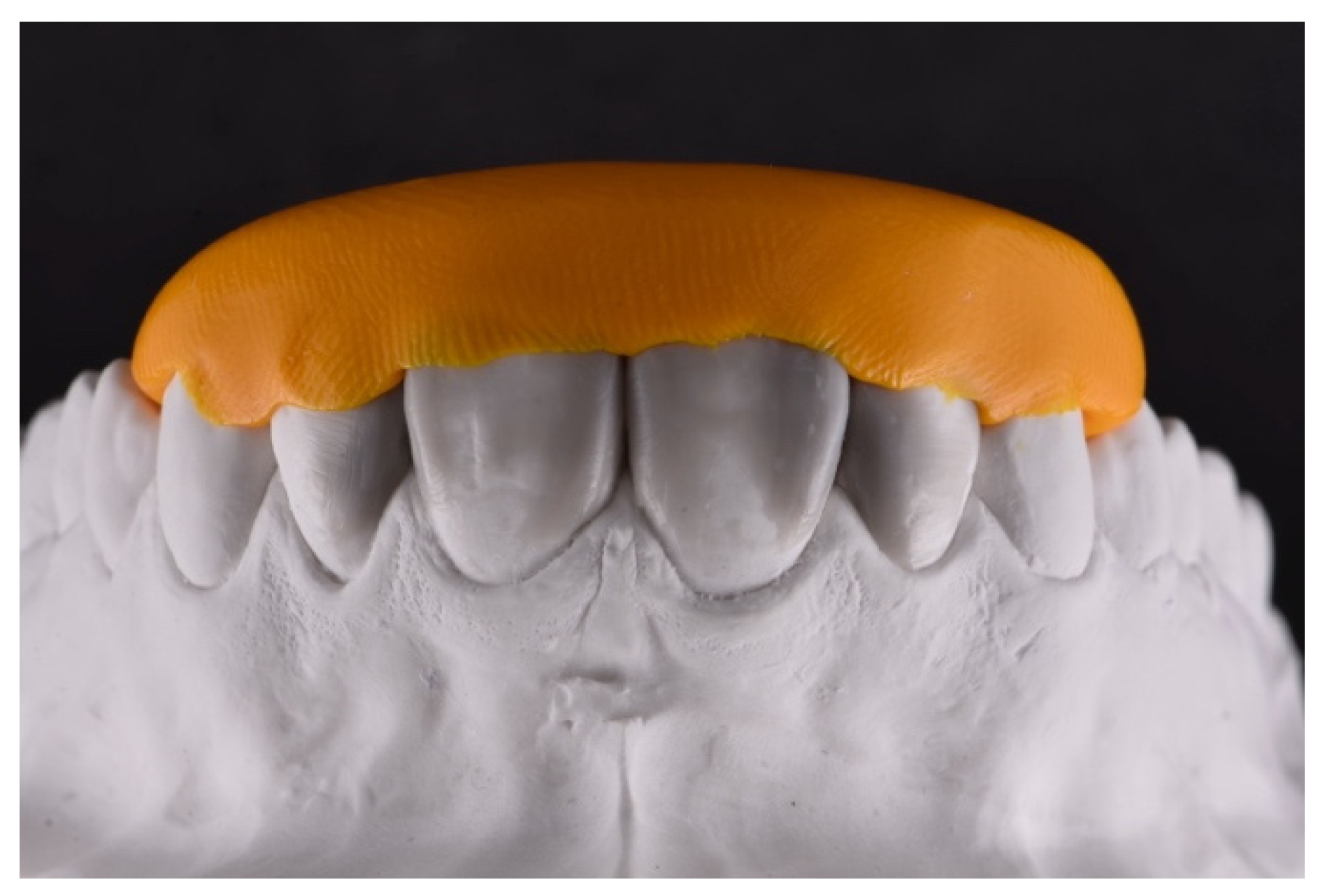 Symmetry 13 00797 g006