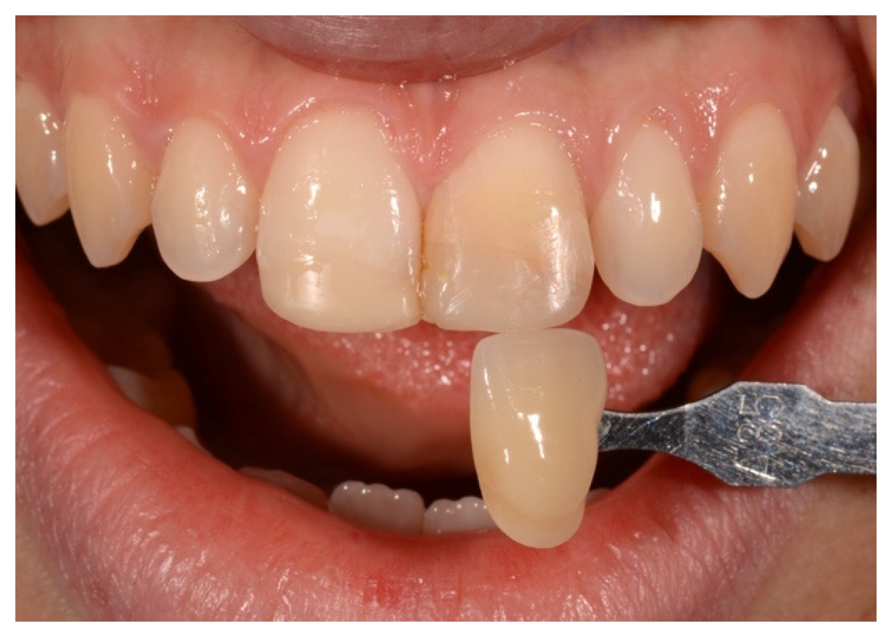 Symmetry 13 00797 g007