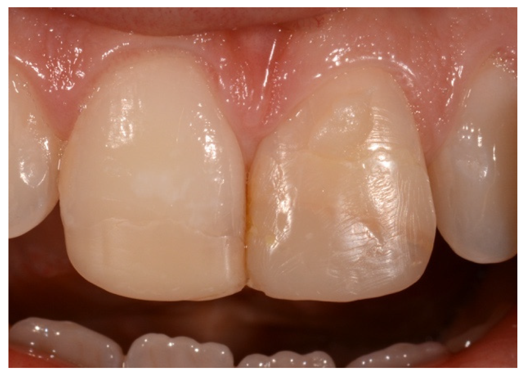 Symmetry 13 00797 g008