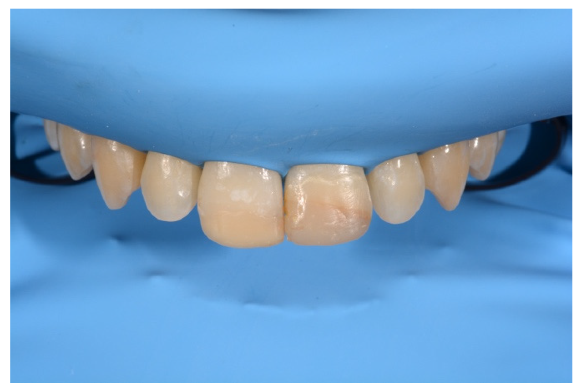 Symmetry 13 00797 g010