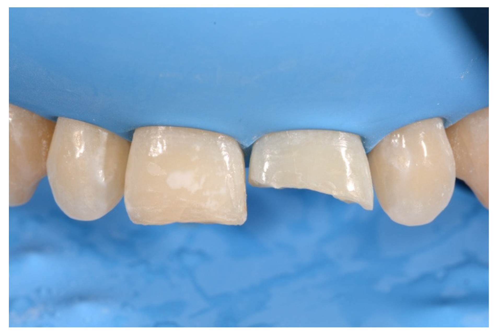 Symmetry 13 00797 g011