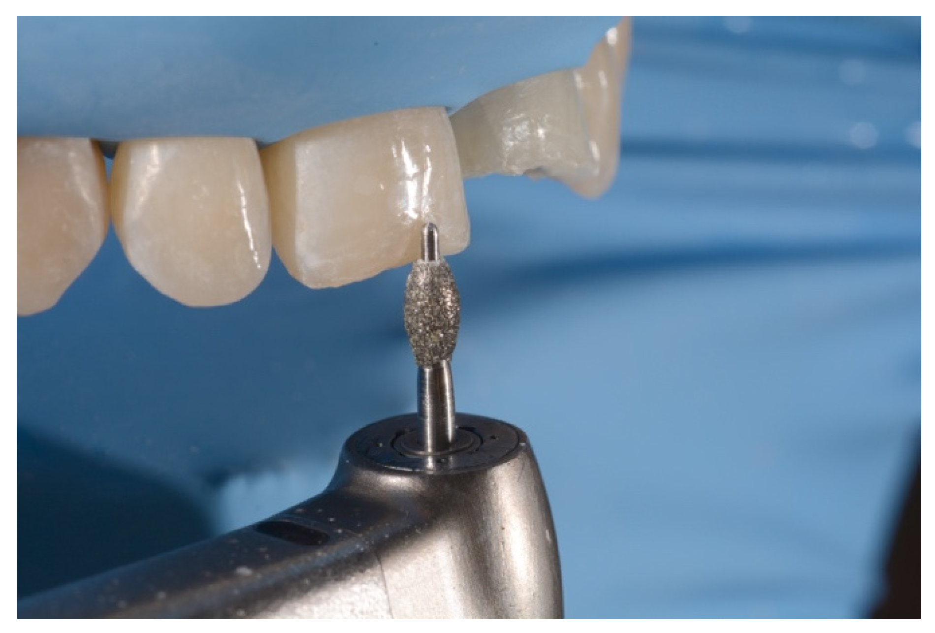 Symmetry 13 00797 g012