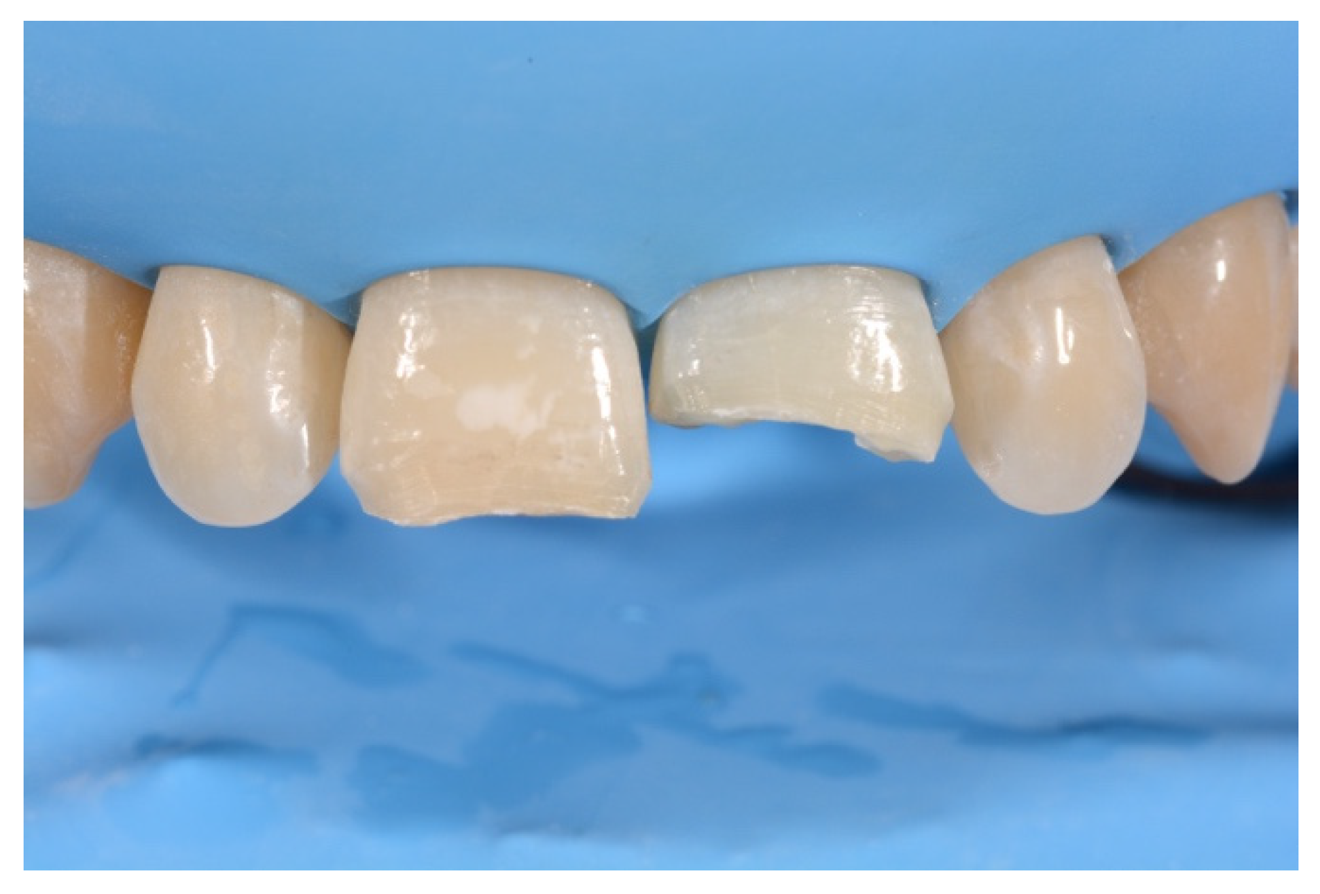 Symmetry 13 00797 g013