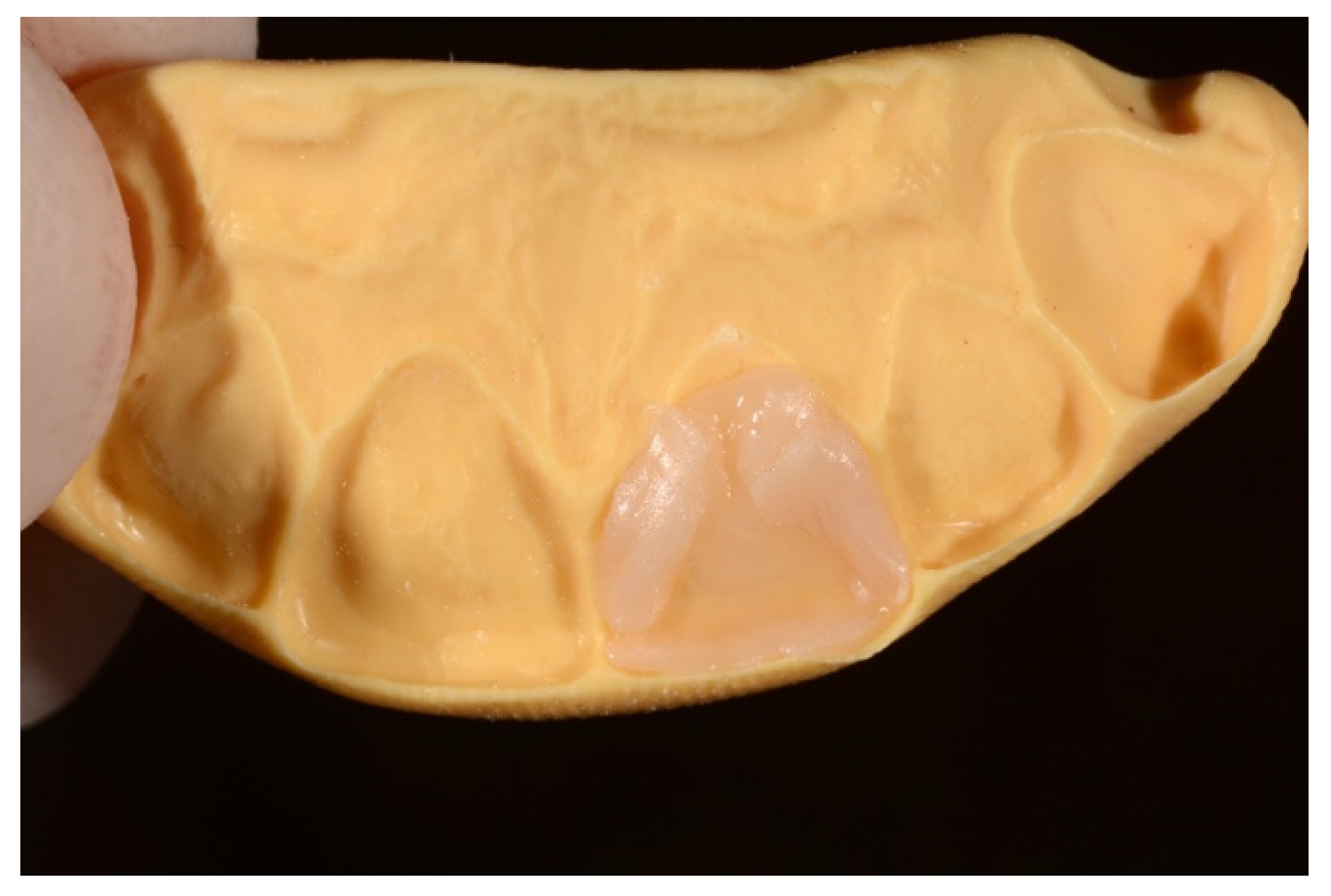 Symmetry 13 00797 g014