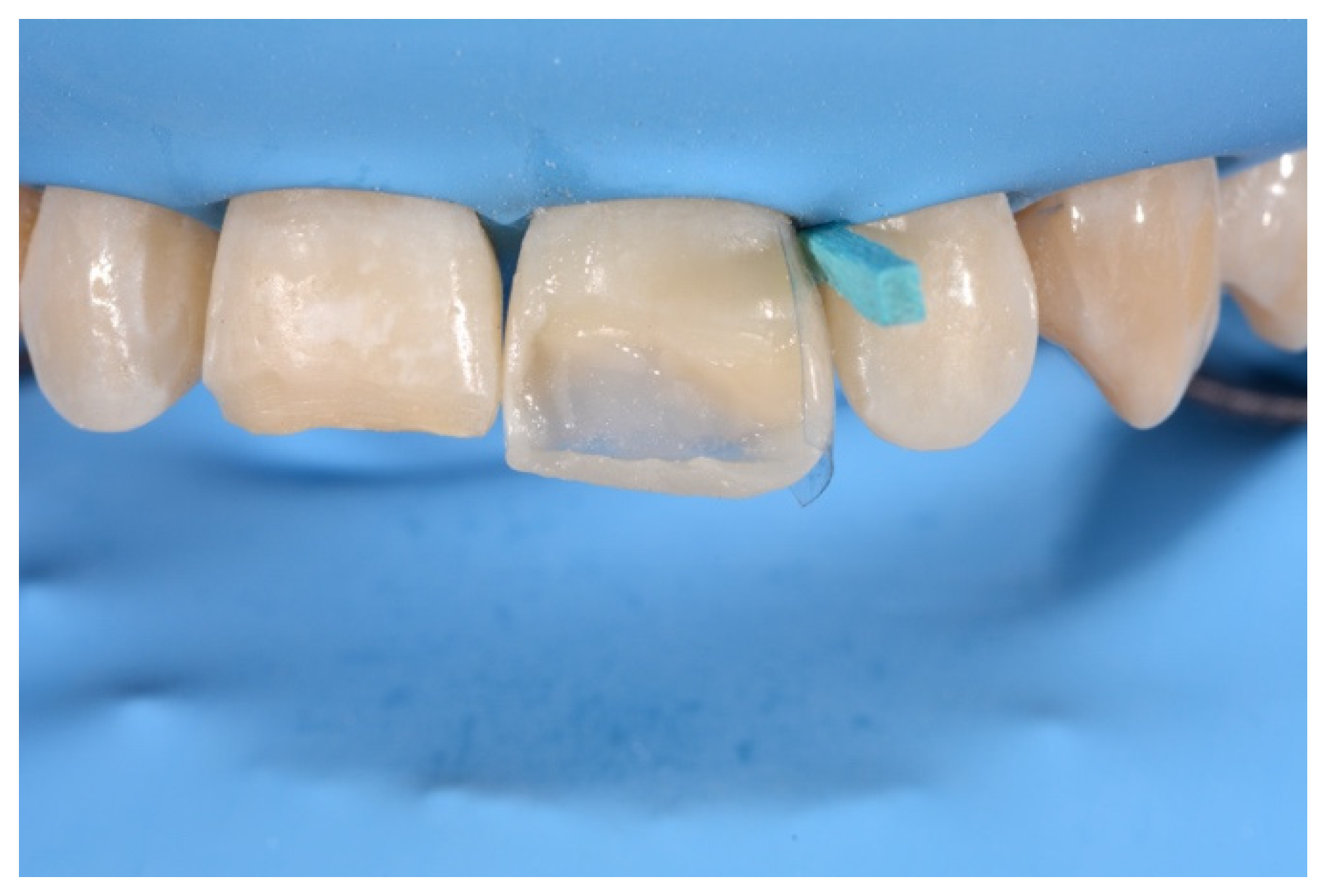 Symmetry 13 00797 g015