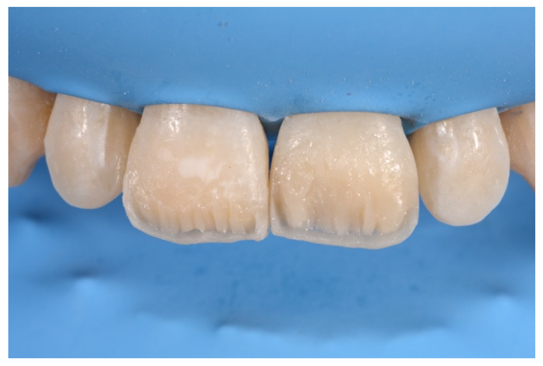 Symmetry 13 00797 g019