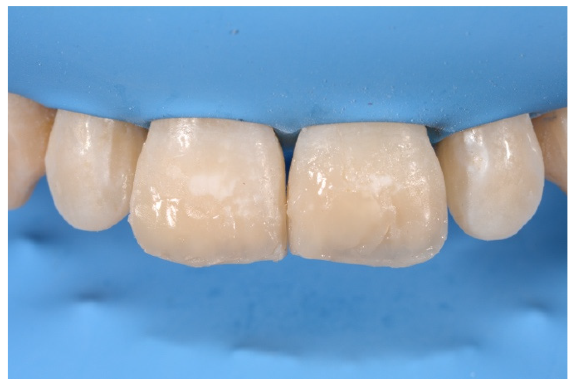 Symmetry 13 00797 g020