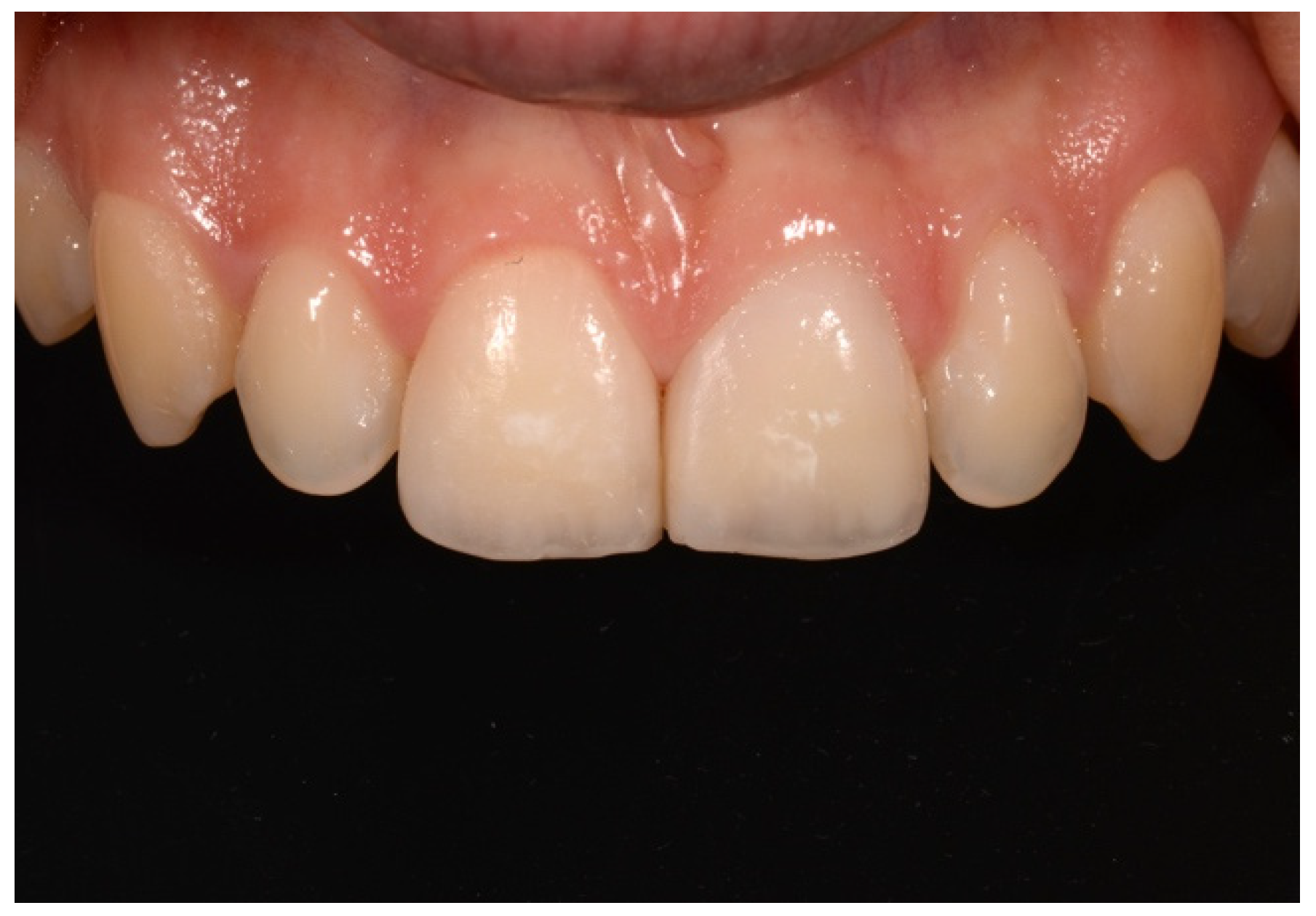 Symmetry 13 00797 g025