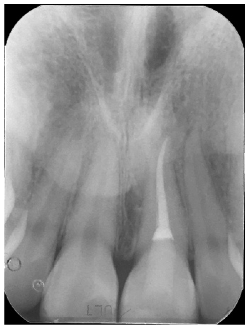 Symmetry 13 00797 g026