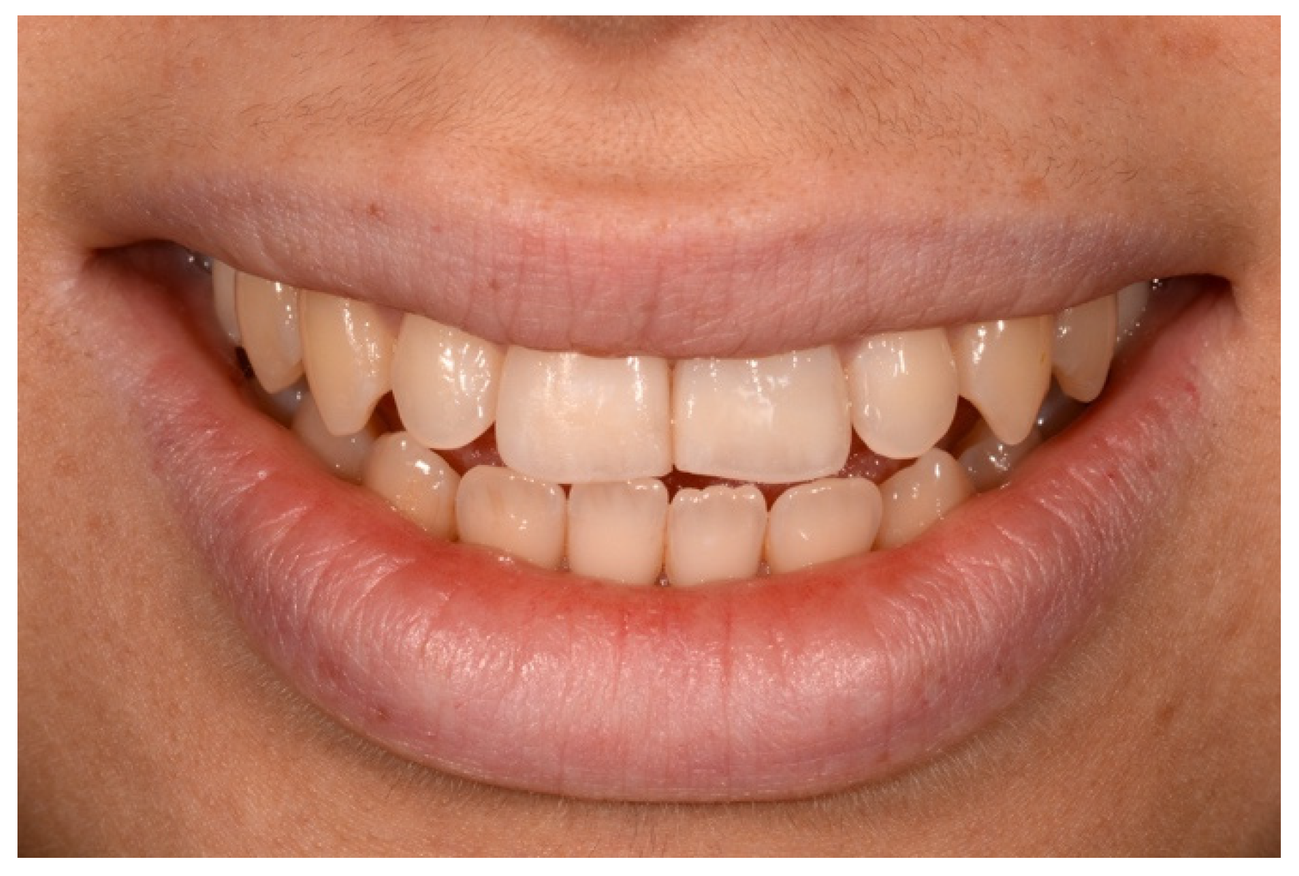 Symmetry 13 00797 g027