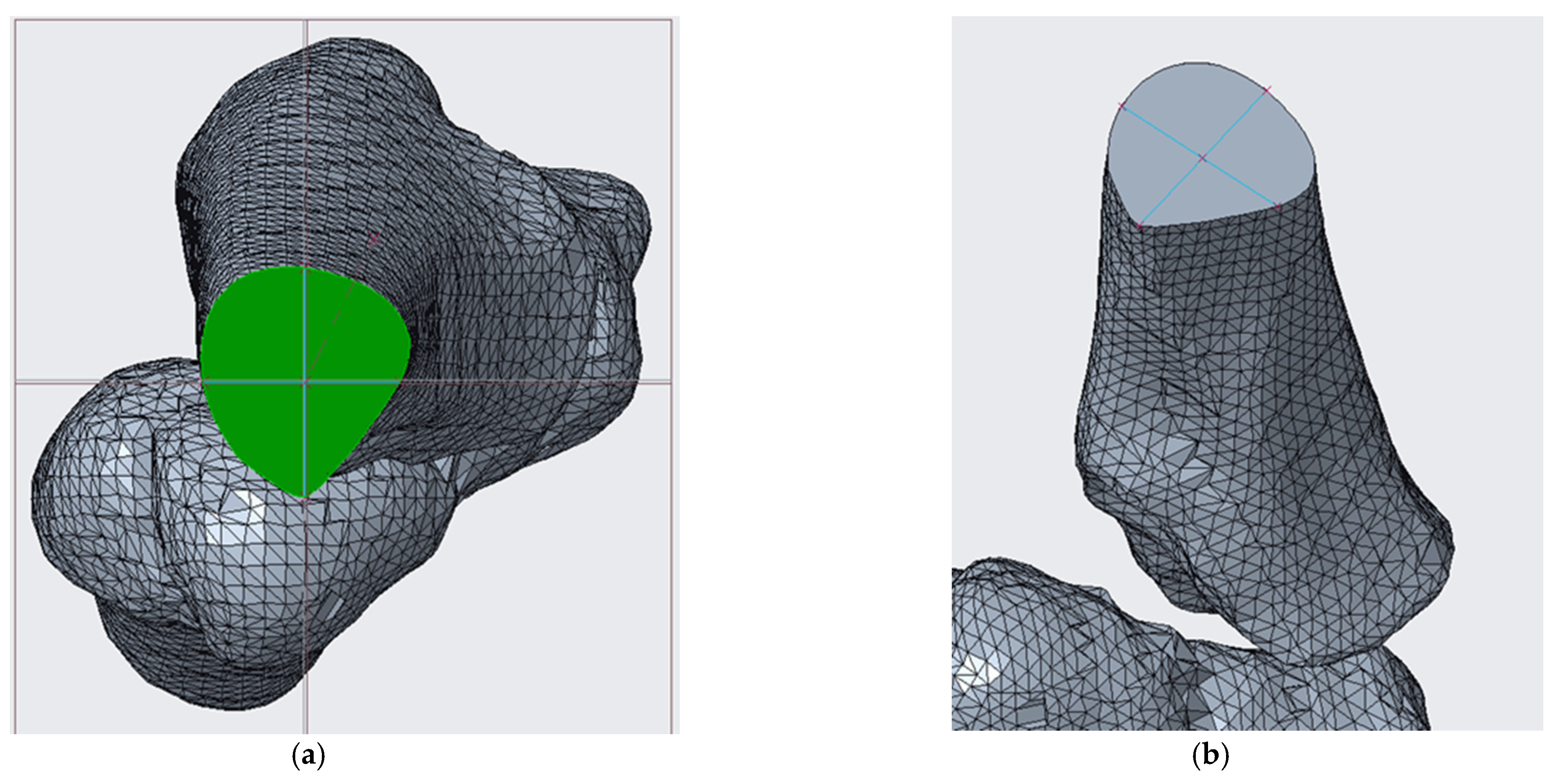 Symmetry 13 00850 g012