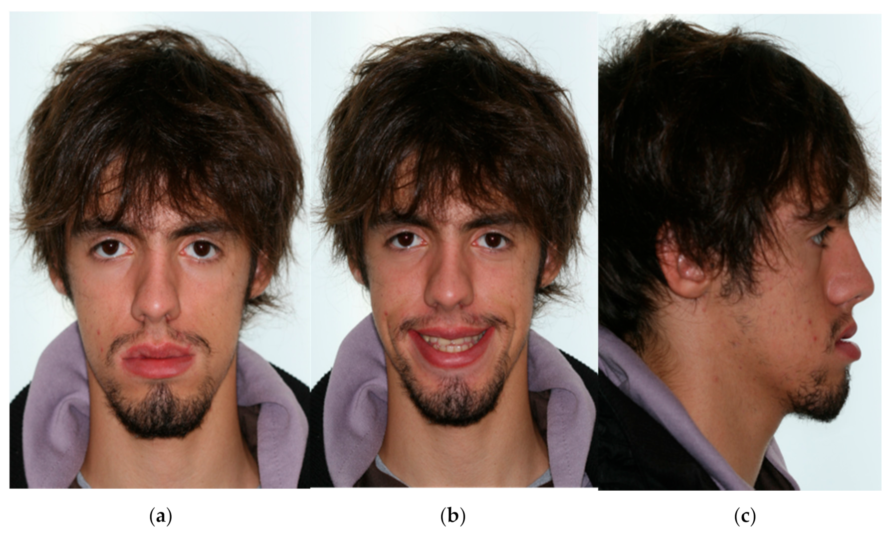 Symmetry 13 01150 g001