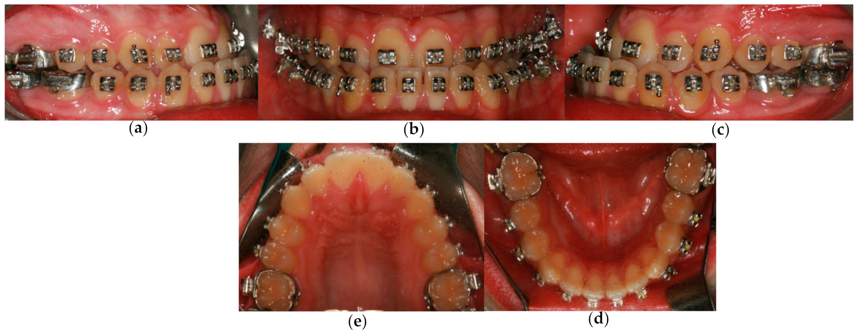 Symmetry 13 01150 g004