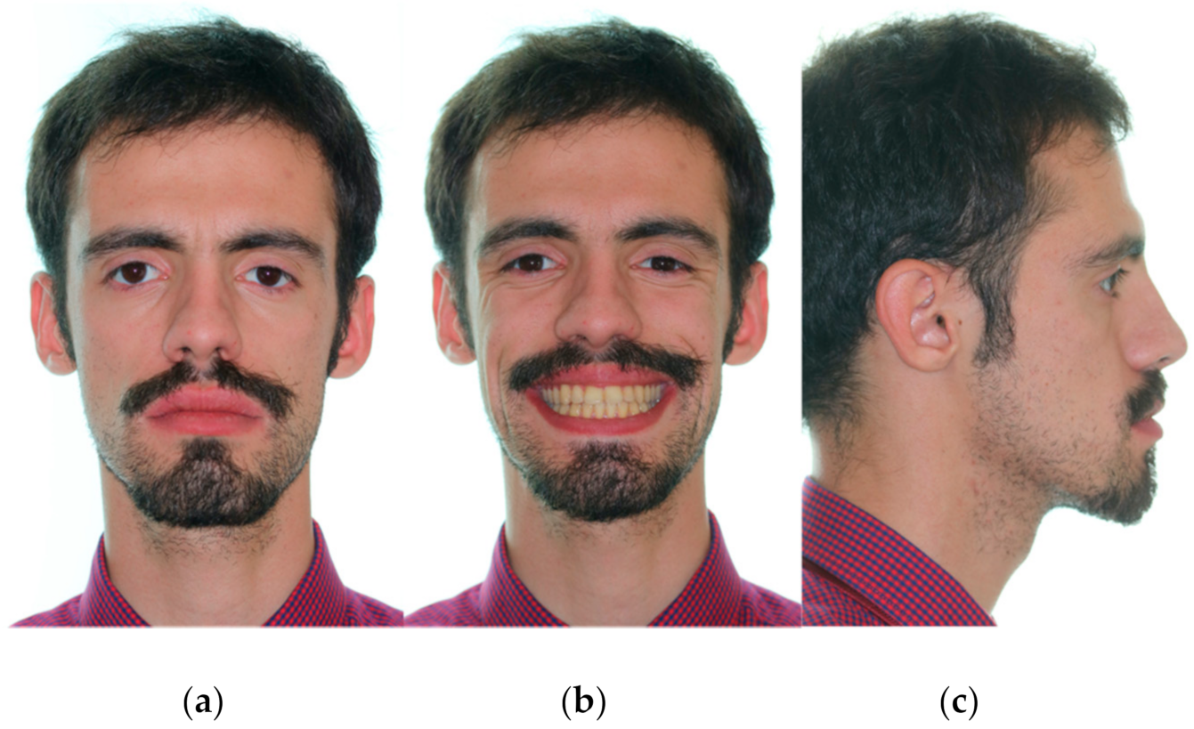 Symmetry 13 01150 g007